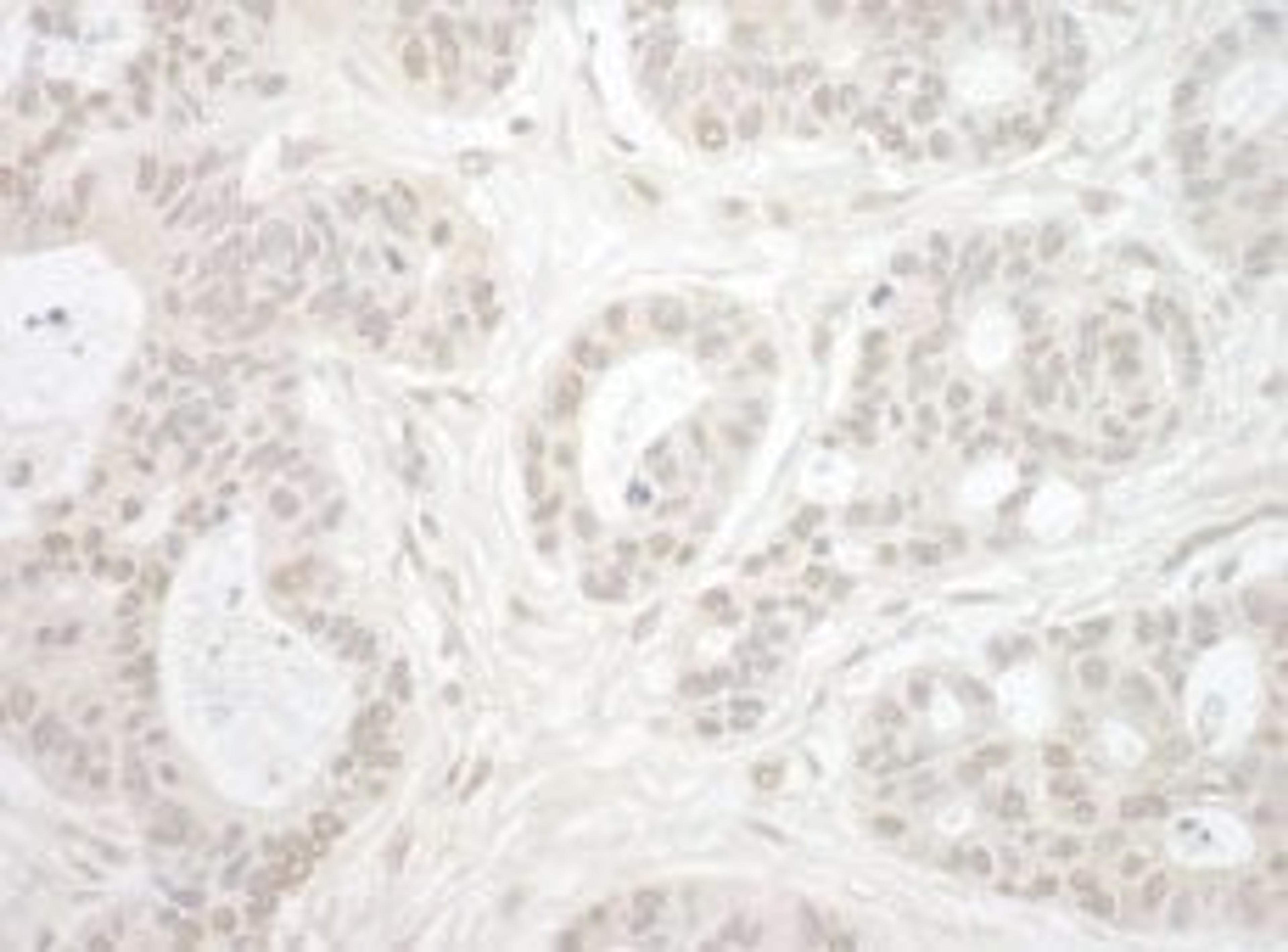 Detection of human Importin 4 by immunohistochemistry.