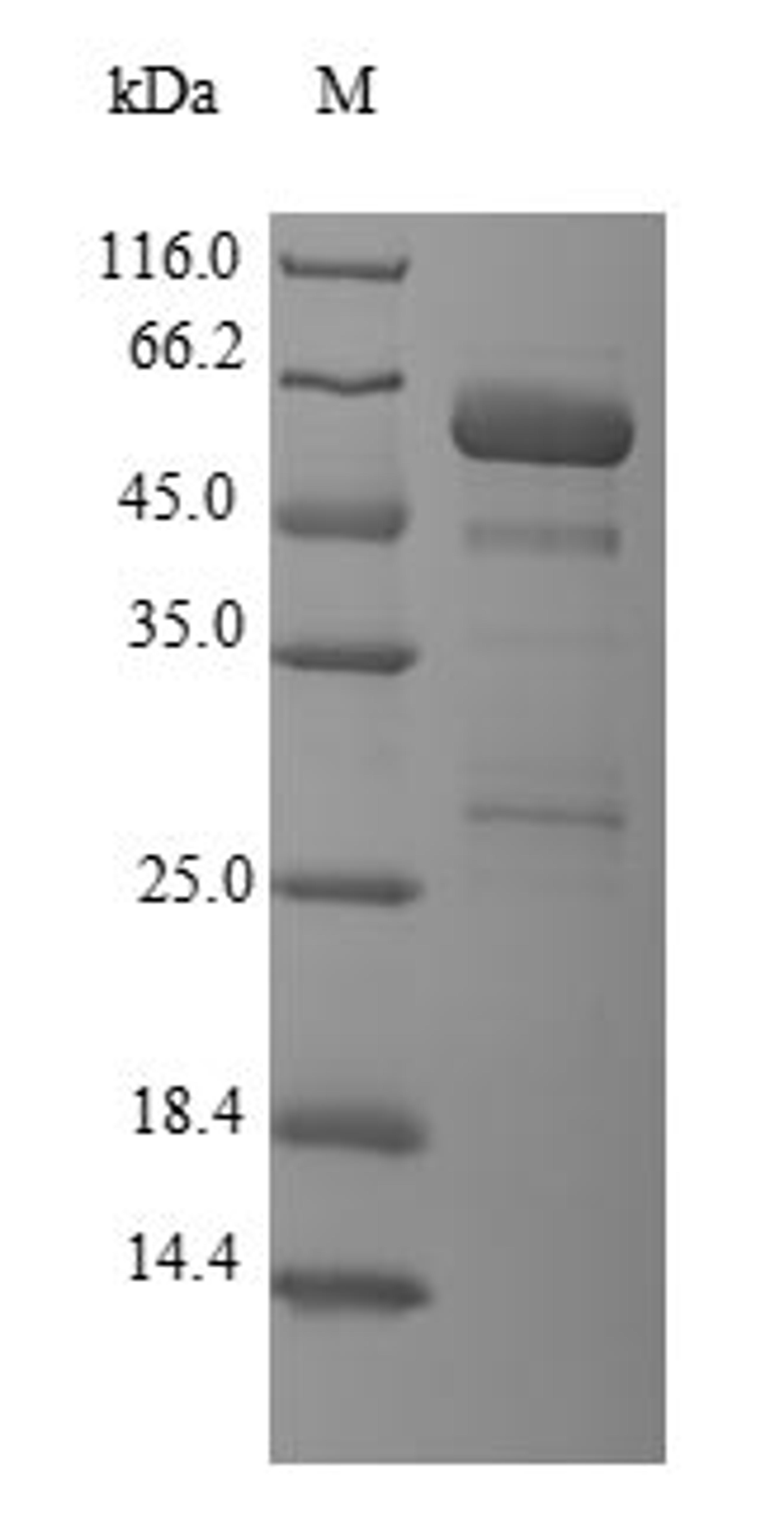 (Tris-Glycine gel) Discontinuous SDS-PAGE (reduced) with 5% enrichment gel and 15% separation gel.
