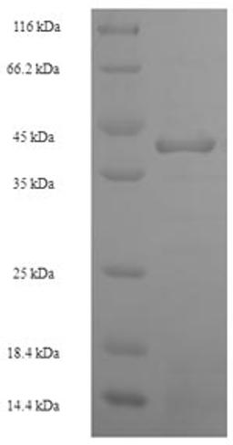 (Tris-Glycine gel) Discontinuous SDS-PAGE (reduced) with 5% enrichment gel and 15% separation gel.