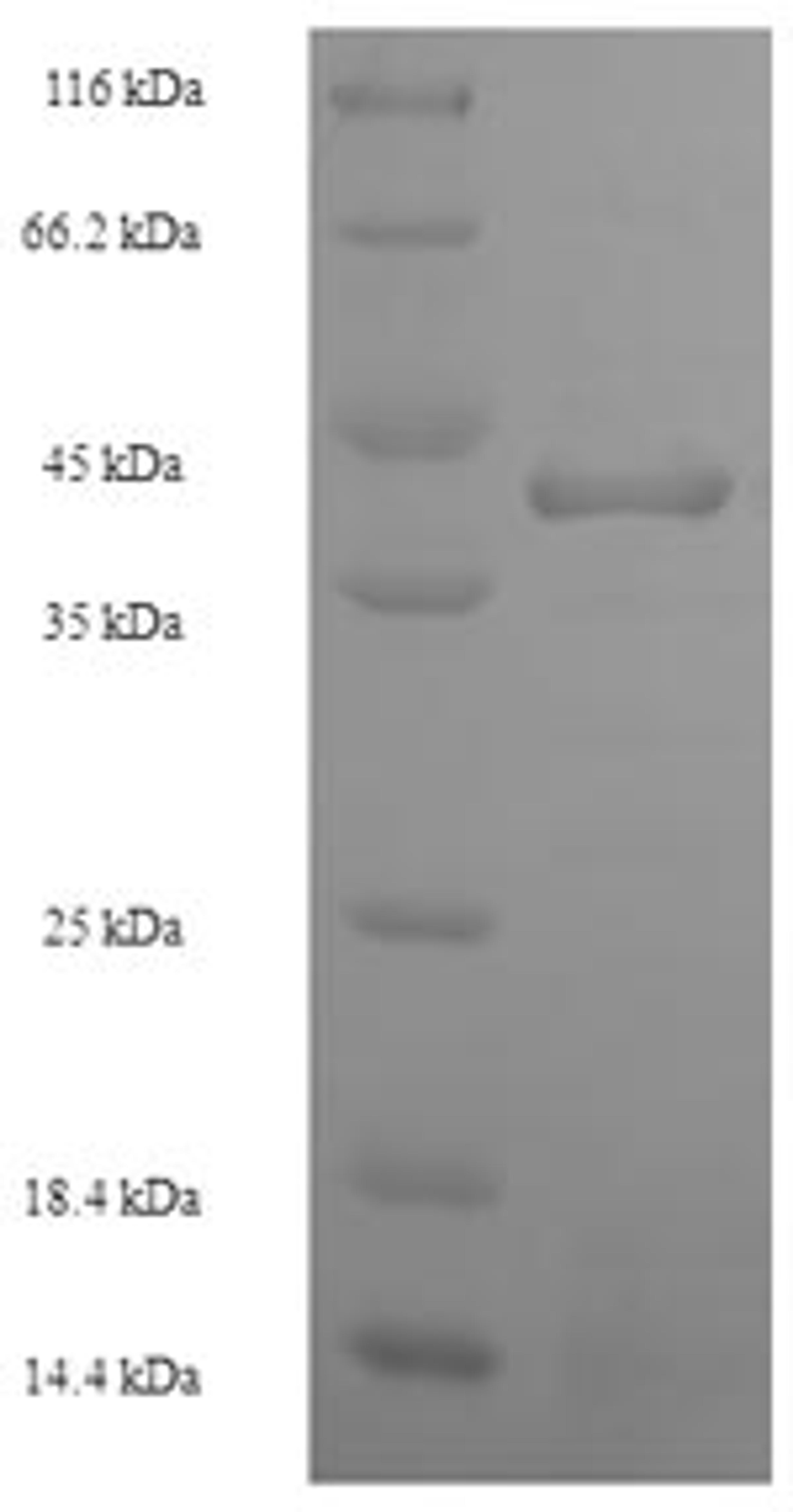 (Tris-Glycine gel) Discontinuous SDS-PAGE (reduced) with 5% enrichment gel and 15% separation gel.