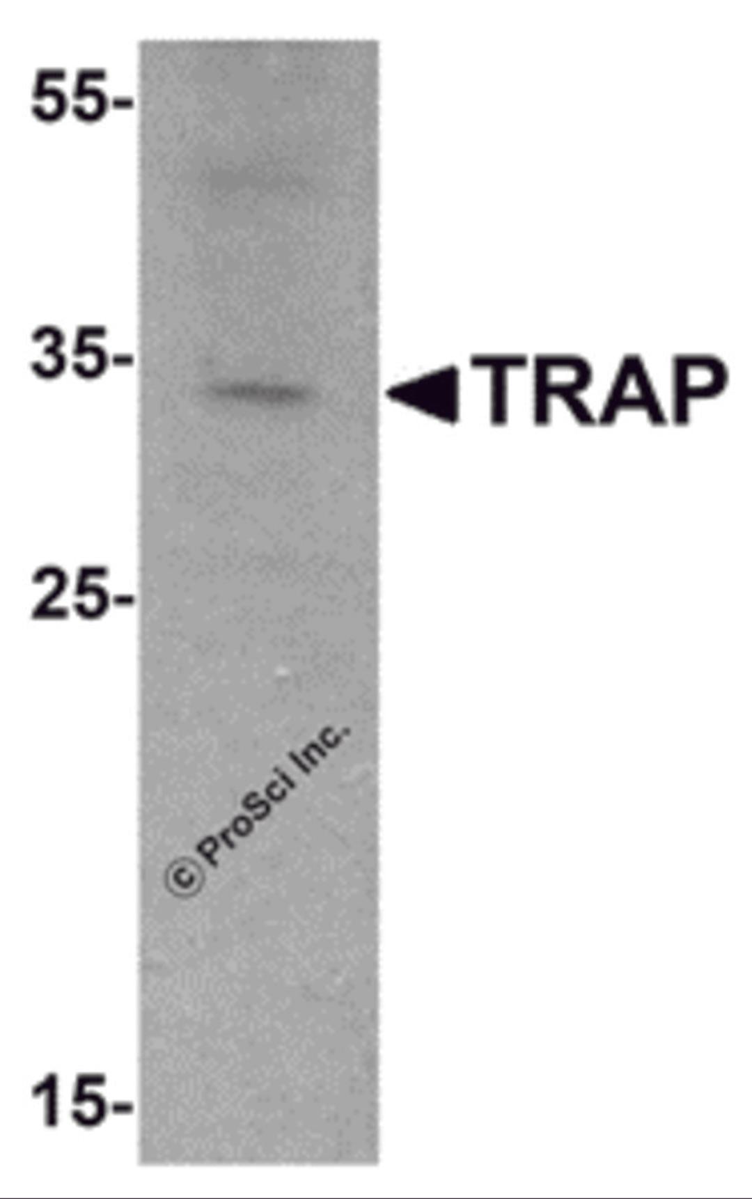 Western blot analysis of TRAP in mouse brain tissue lysate with TRAP antibody at 1 μg/mL.