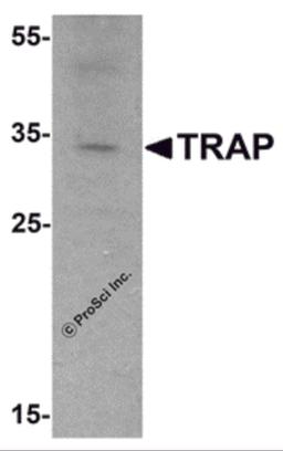 Western blot analysis of TRAP in mouse brain tissue lysate with TRAP antibody at 1 μg/mL.