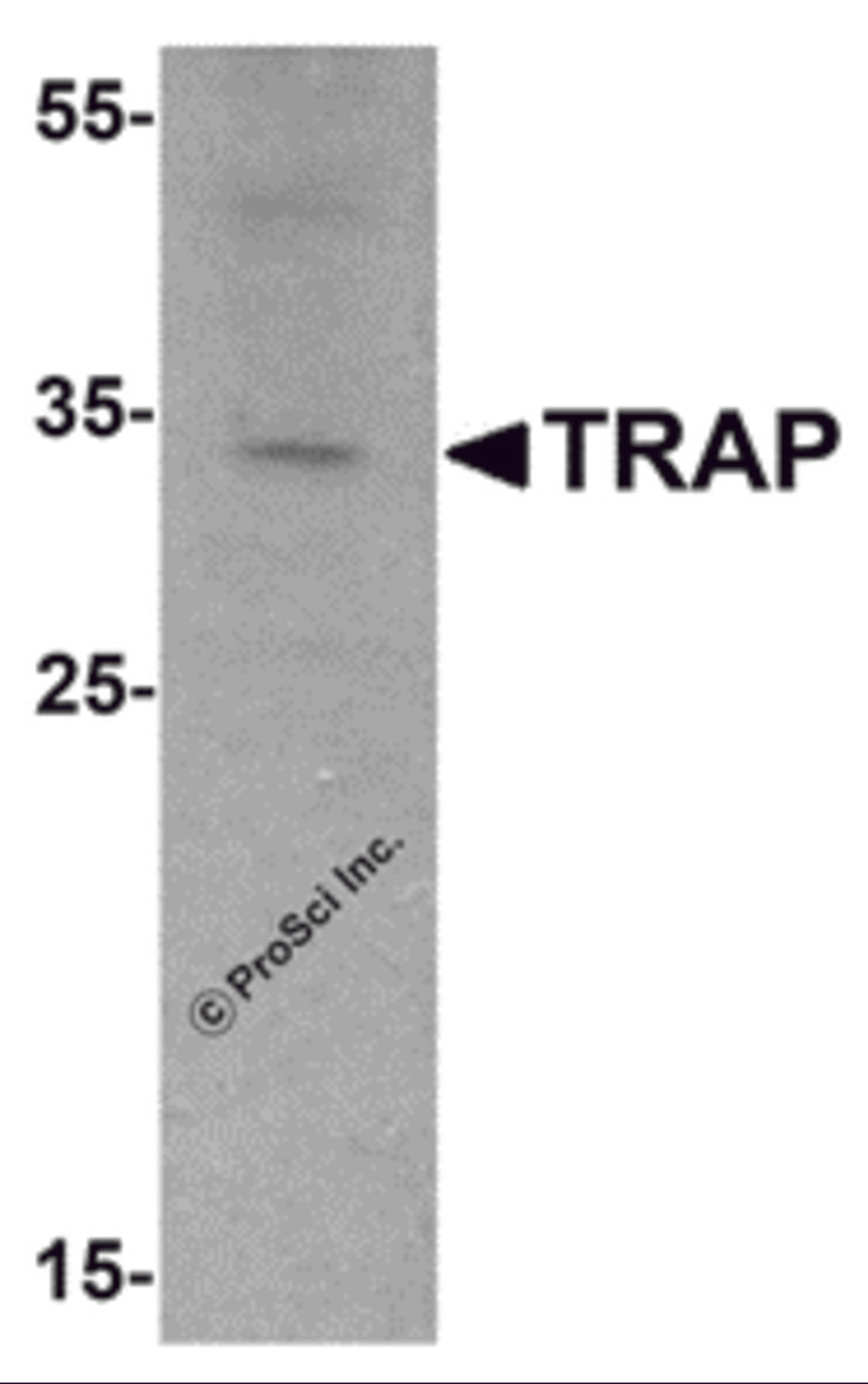 Western blot analysis of TRAP in mouse brain tissue lysate with TRAP antibody at 1 μg/mL.