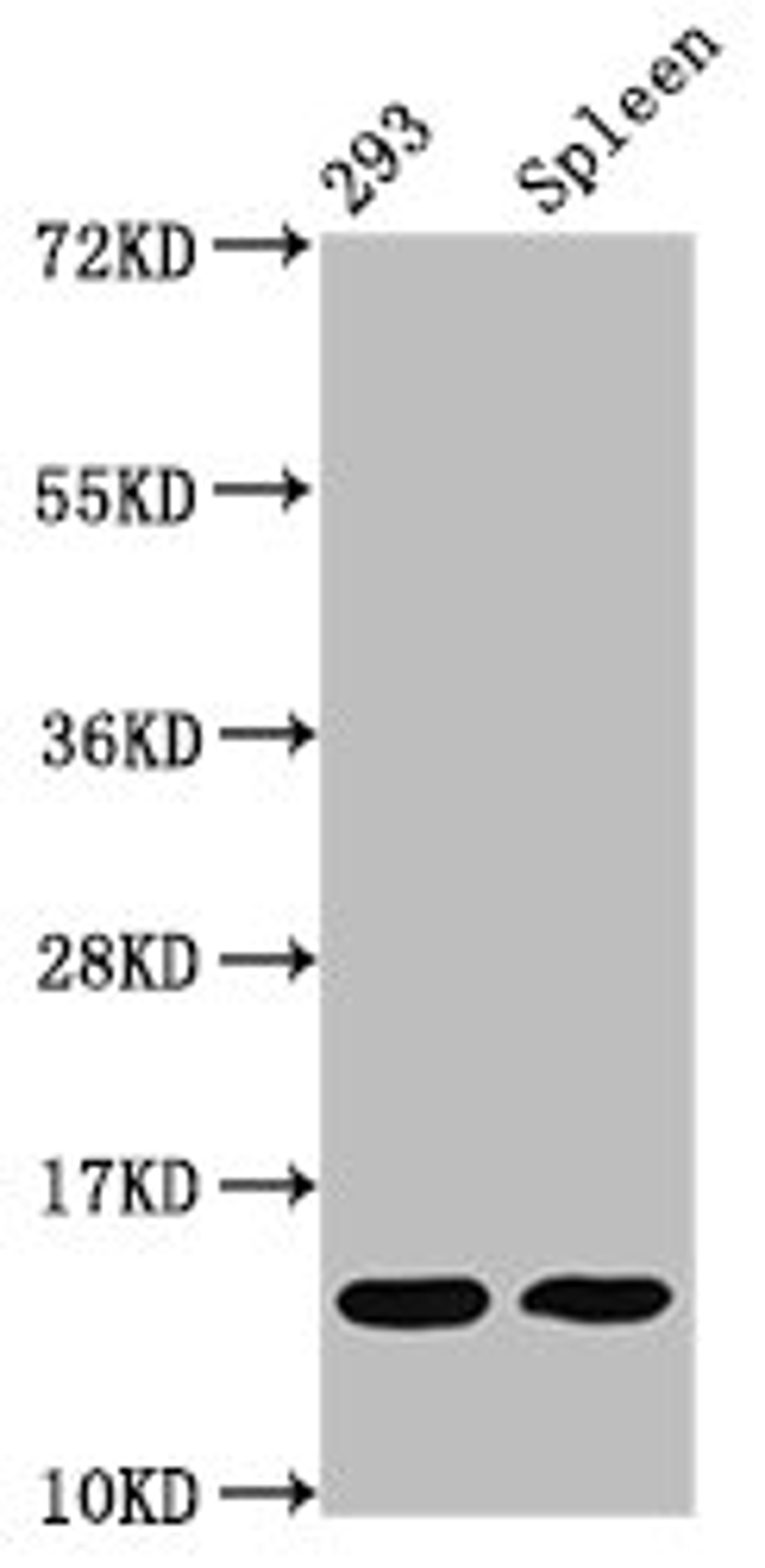 Western Blot. Positive WB detected in: 293 whole cell lysate, Mouse spleen tissue. All lanes: HIST1H2BC antibody at 0.09µg/ml. Secondary. Goat polyclonal to rabbit IgG at 1/50000 dilution. Predicted band size: 14 kDa. Observed band size: 14 kDa