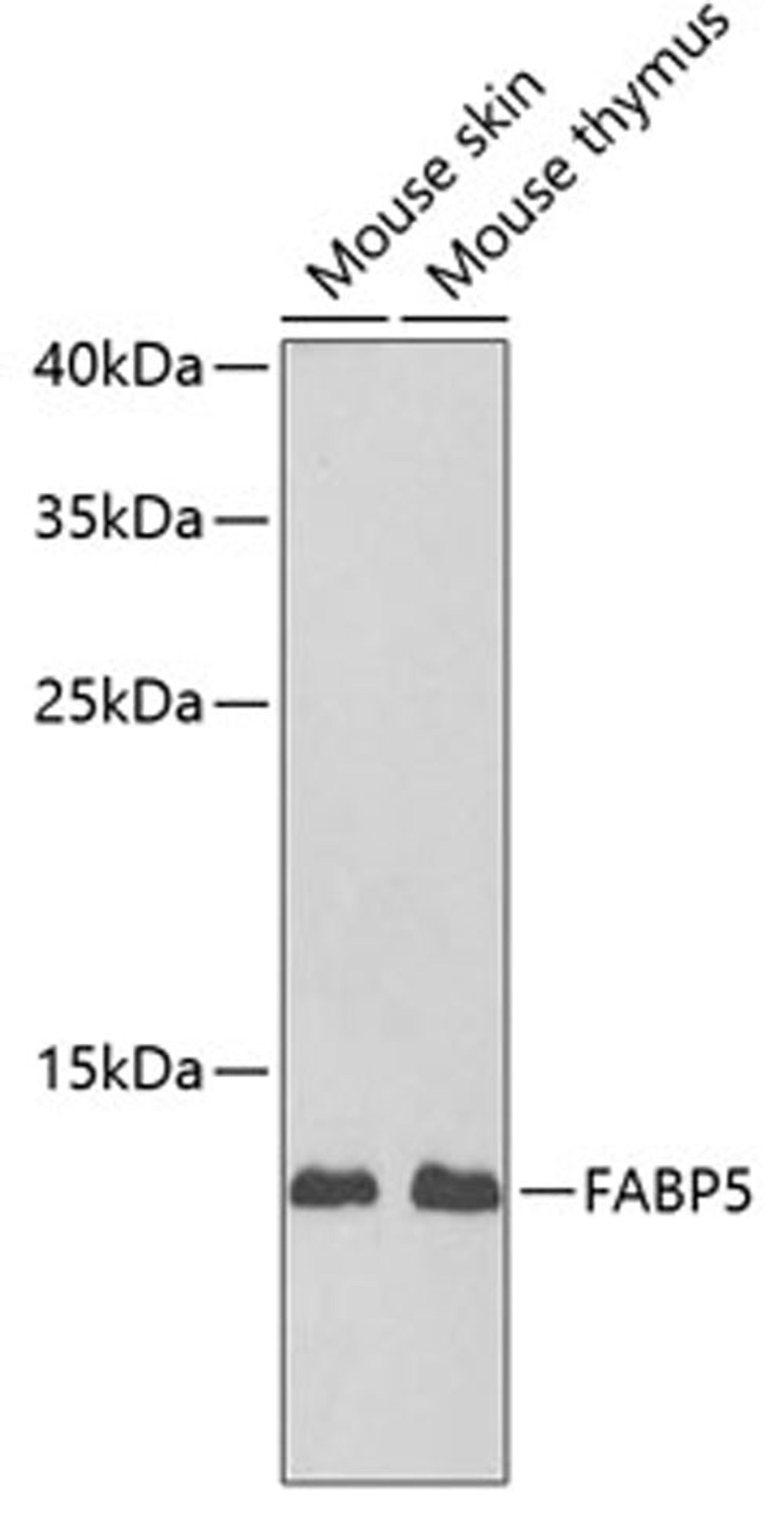 Western blot - FABP5 antibody (A6373)