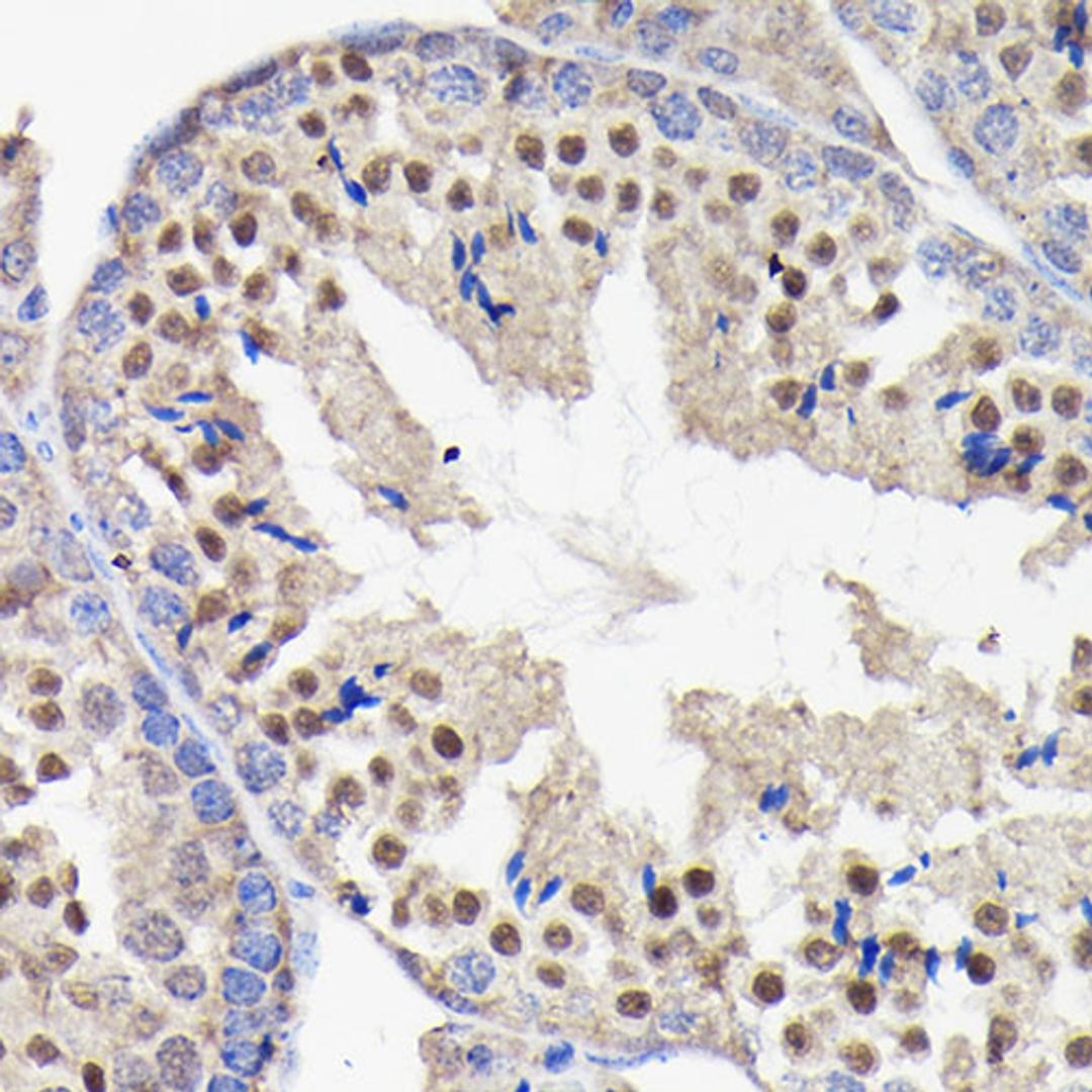 Immunohistochemistry  - PI 3 Kinase p85 beta Rabbit mAb (A4860)