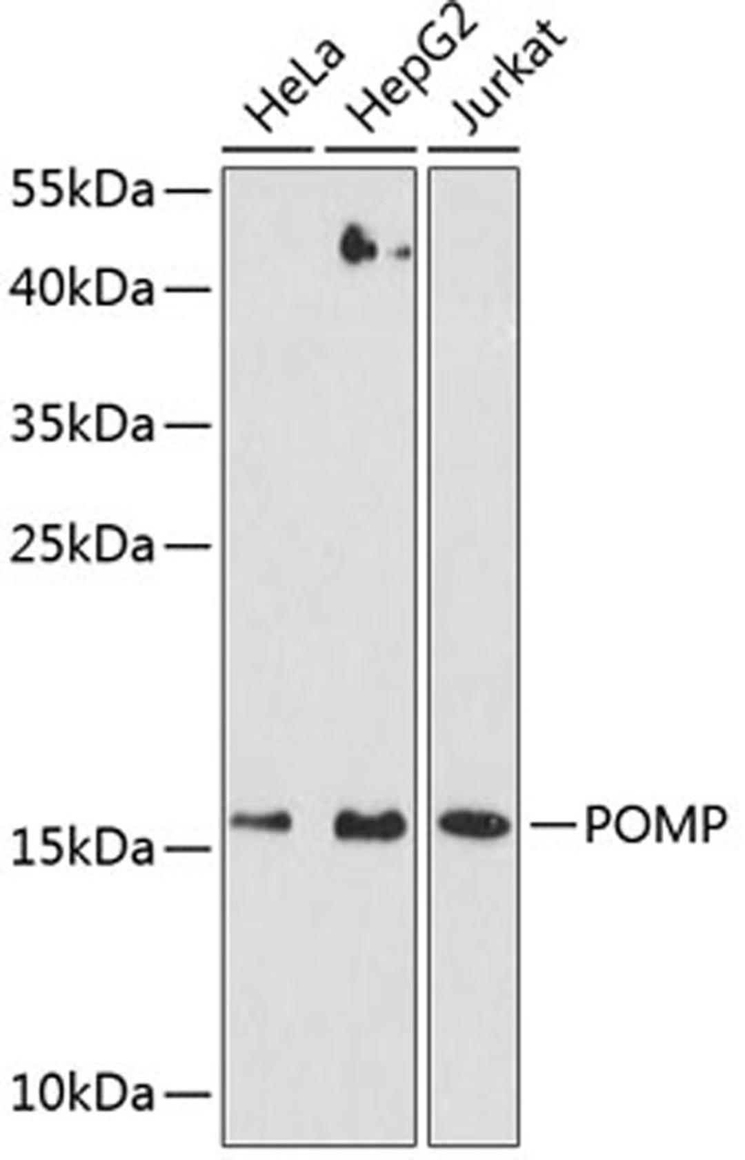 Western blot - POMP antibody (A9067)