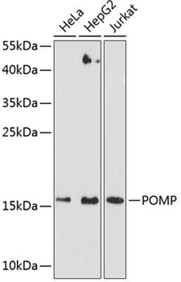 Western blot - POMP antibody (A9067)