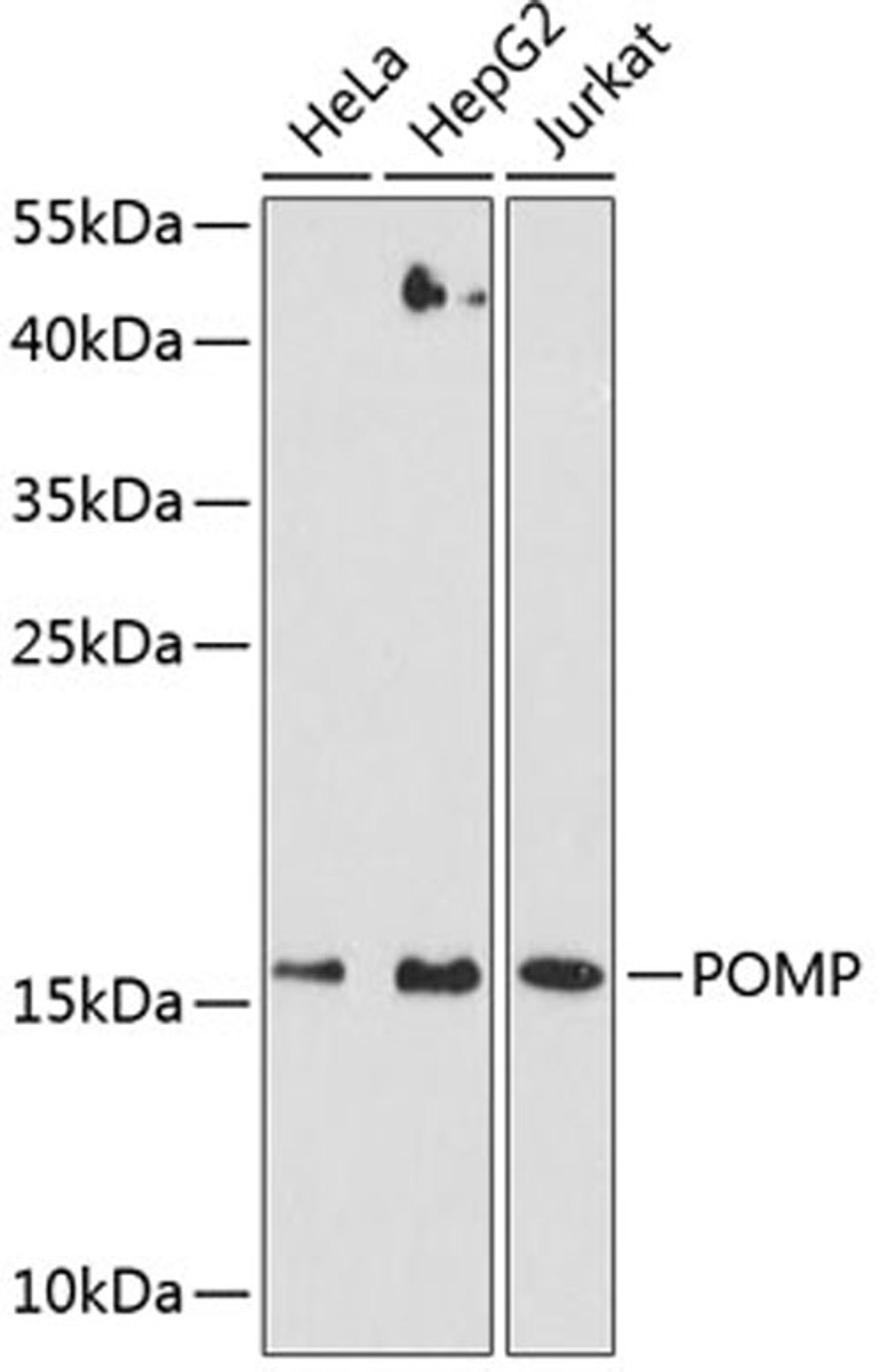 Western blot - POMP antibody (A9067)