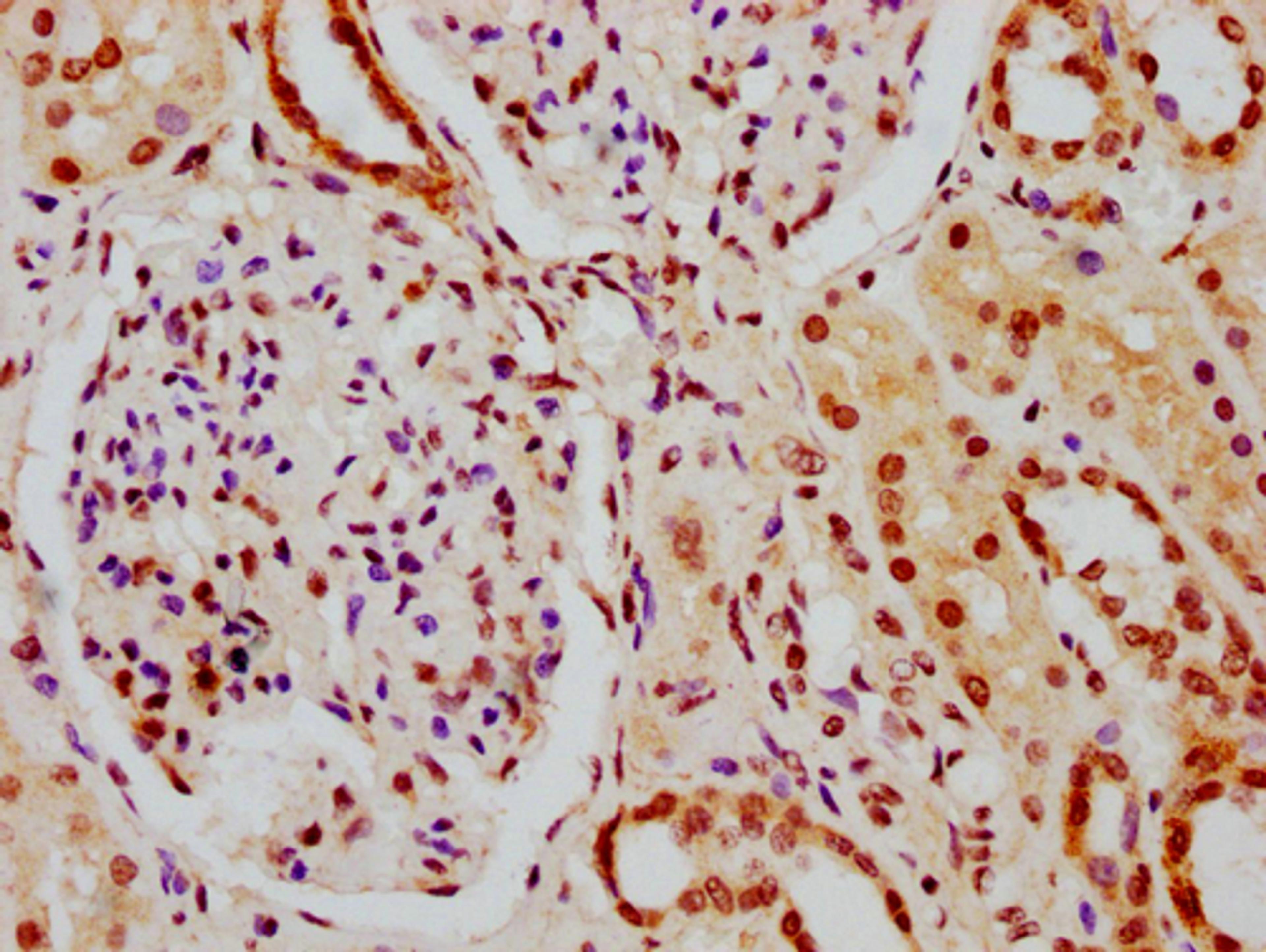 IHC image of CSB-PA010378PA164nphHU diluted at 1:10 and staining in paraffin-embedded human kidney tissue performed on a Leica BondTM system. After dewaxing and hydration, antigen retrieval was mediated by high pressure in a citrate buffer (pH 6.0). Section was blocked with 10% normal goat serum 30min at RT. Then primary antibody (1% BSA) was incubated at 4°C overnight. The primary is detected by a biotinylated secondary antibody and visualized using an HRP conjugated SP system.