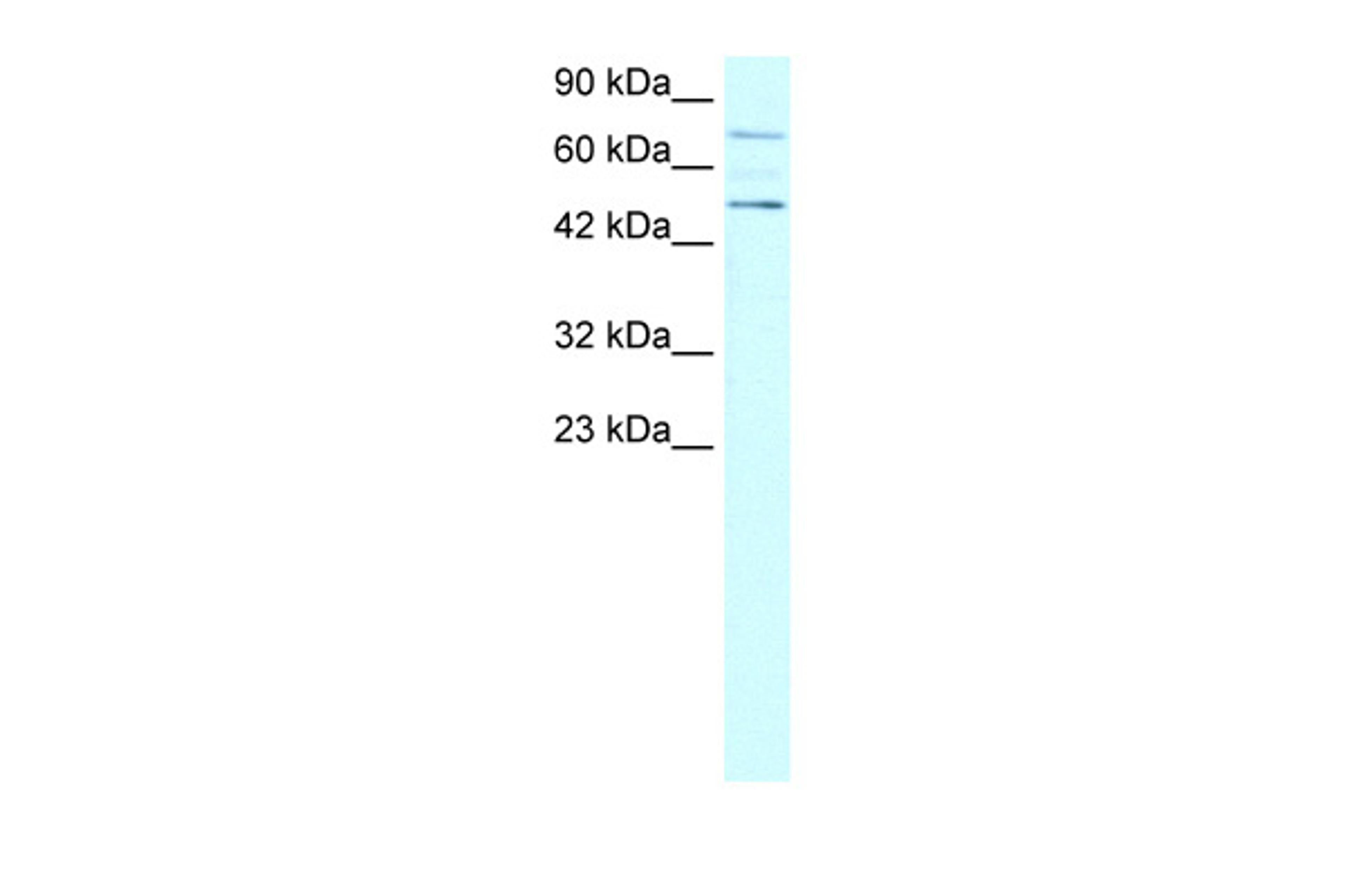 Antibody used in WB on Human Jurkat 0.2-1 ug/ml.