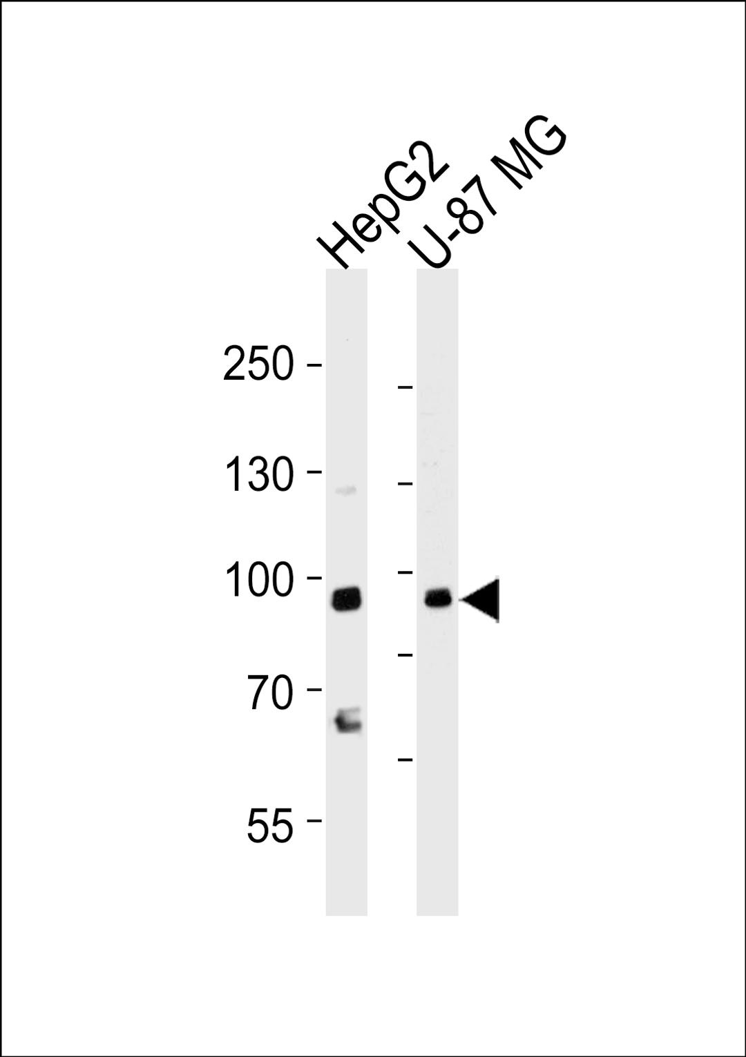 Western blot analysis of lysates from HepG2, U-87 MG cell line (from left to right), using URG4 Antibody at 1:1000 at each lane.