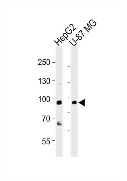 Western blot analysis of lysates from HepG2, U-87 MG cell line (from left to right), using URG4 Antibody at 1:1000 at each lane.