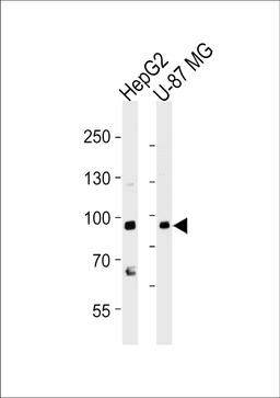 Western blot analysis of lysates from HepG2, U-87 MG cell line (from left to right), using URG4 Antibody at 1:1000 at each lane.