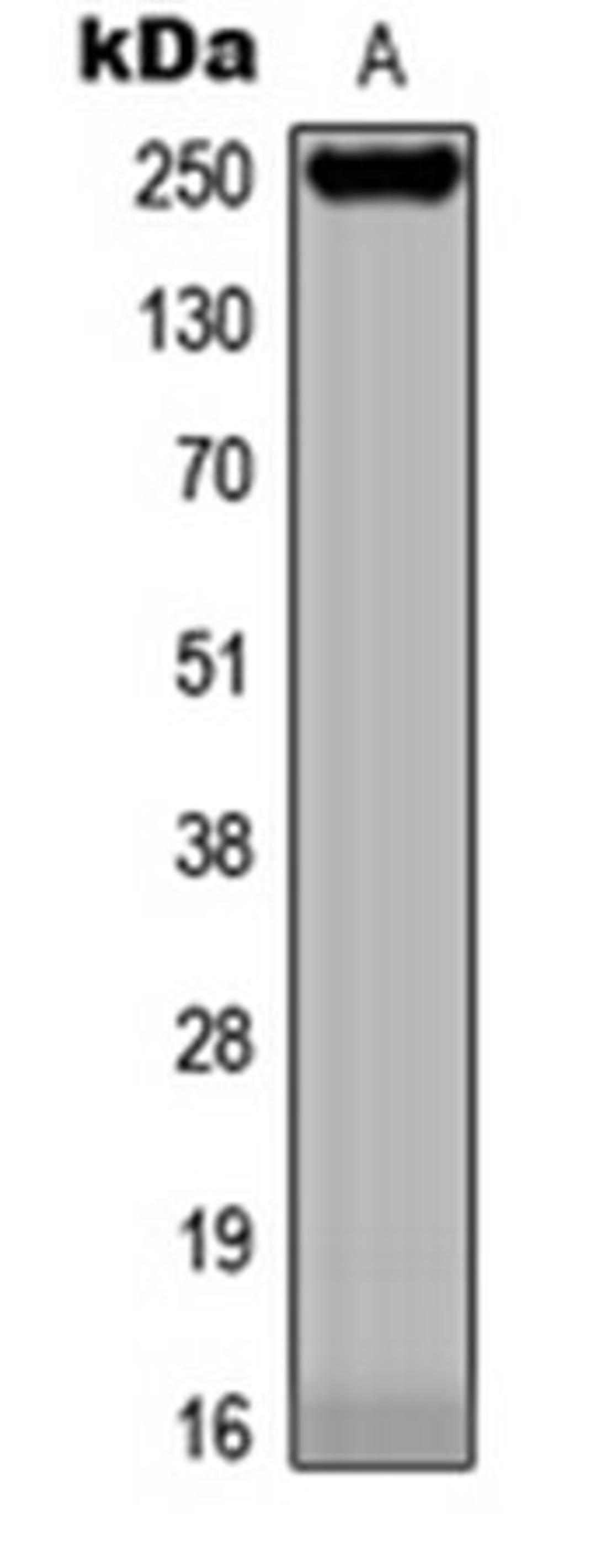 Western blot analysis of A431 (Lane 1) whole cell lysates using BCOX1 antibody