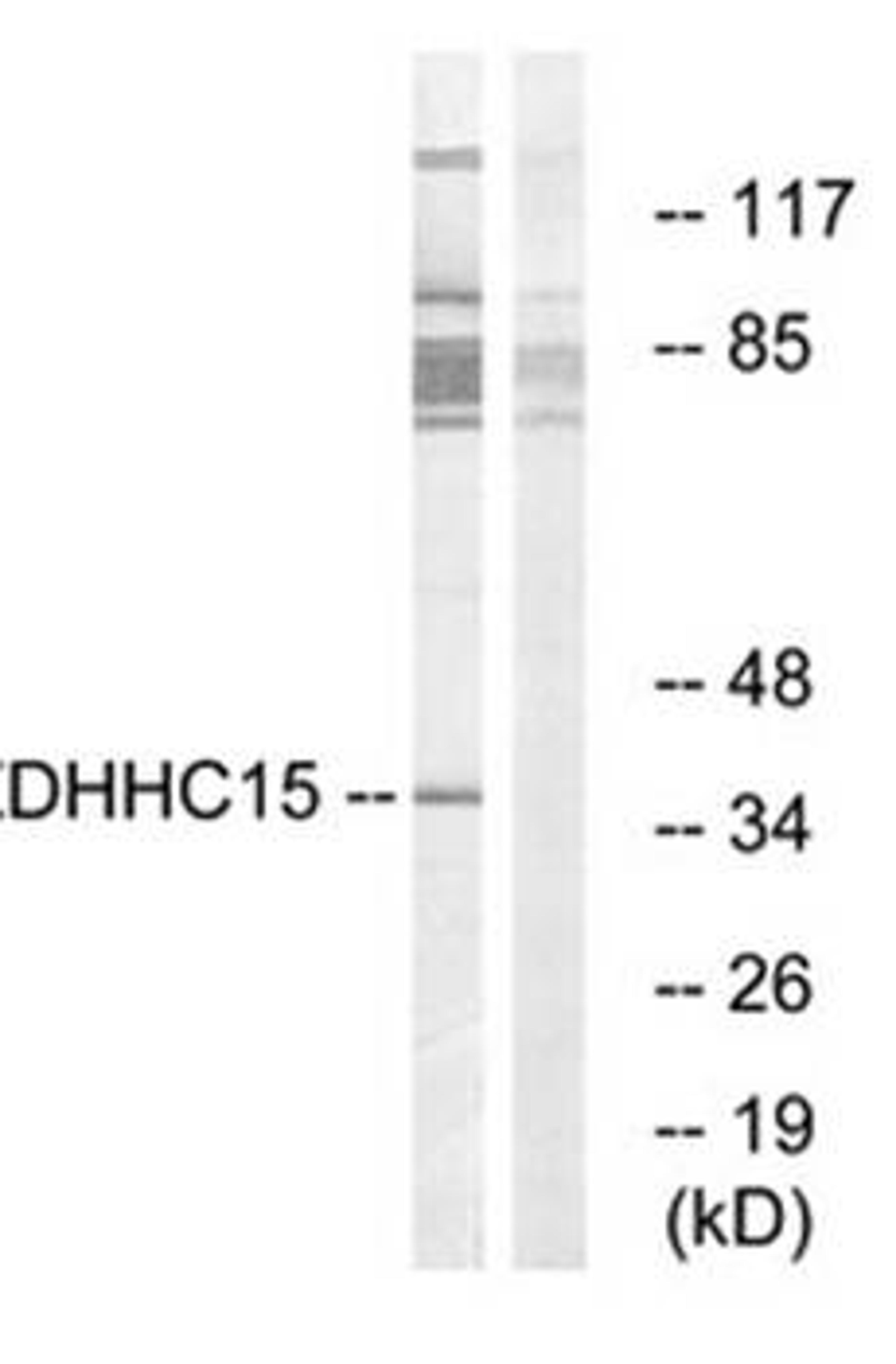 Western blot analysis of Jurkat cell lysate using DHHC-15 antibody (Dilution at 1:200)