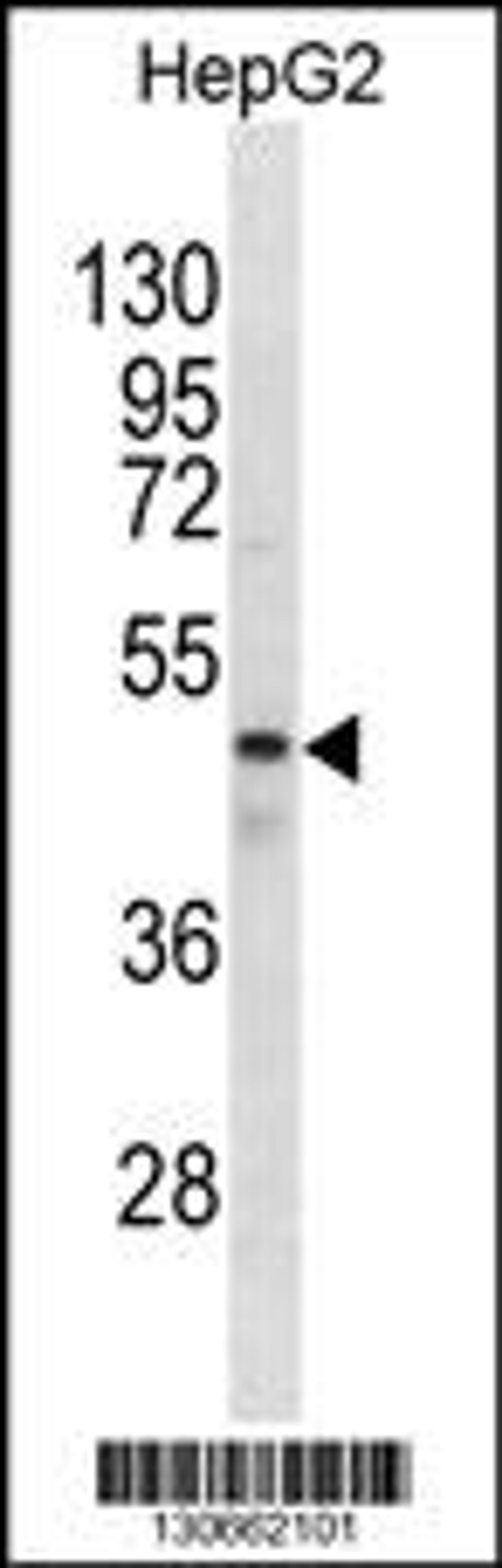 Western blot analysis in HepG2 cell line lysates (35ug/lane).