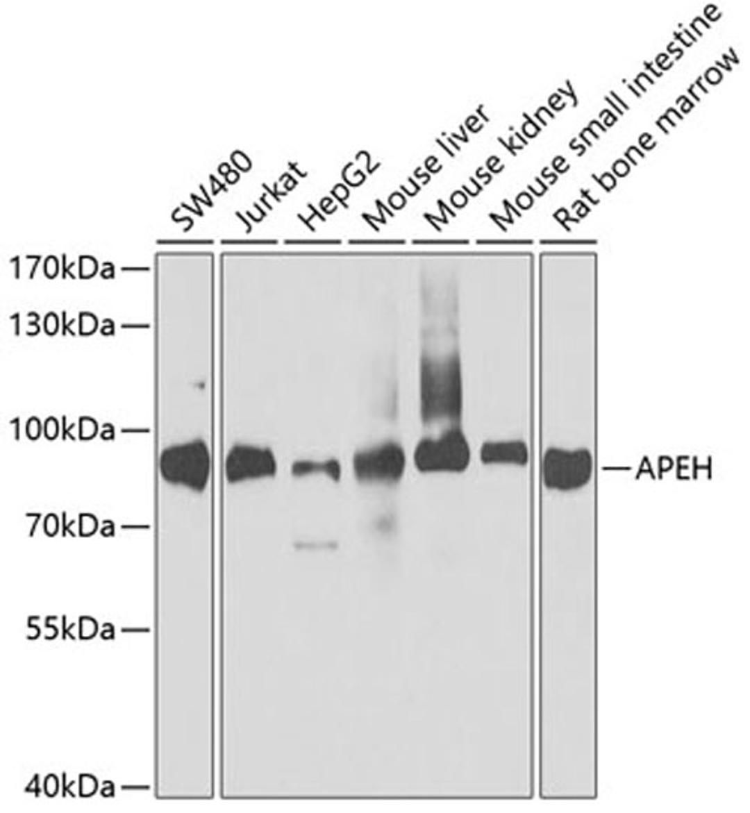 Western blot - APEH antibody (A5893)