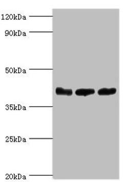 Western blot. All lanes: ADP-ribosylation factor GTPase-activating protein 1 antibody at 5ug/ml. Lane 1: PC-3 whole cell lysate. Lane 2: Hela whole cell lysate. Lane 3: Mouse brain tissue. Secondary. Goat polyclonal to rabbit IgG at 1/10000 dilution. Predicted band size: 45, 46, 32, 40 kDa. Observed band size: 45 kDa.
