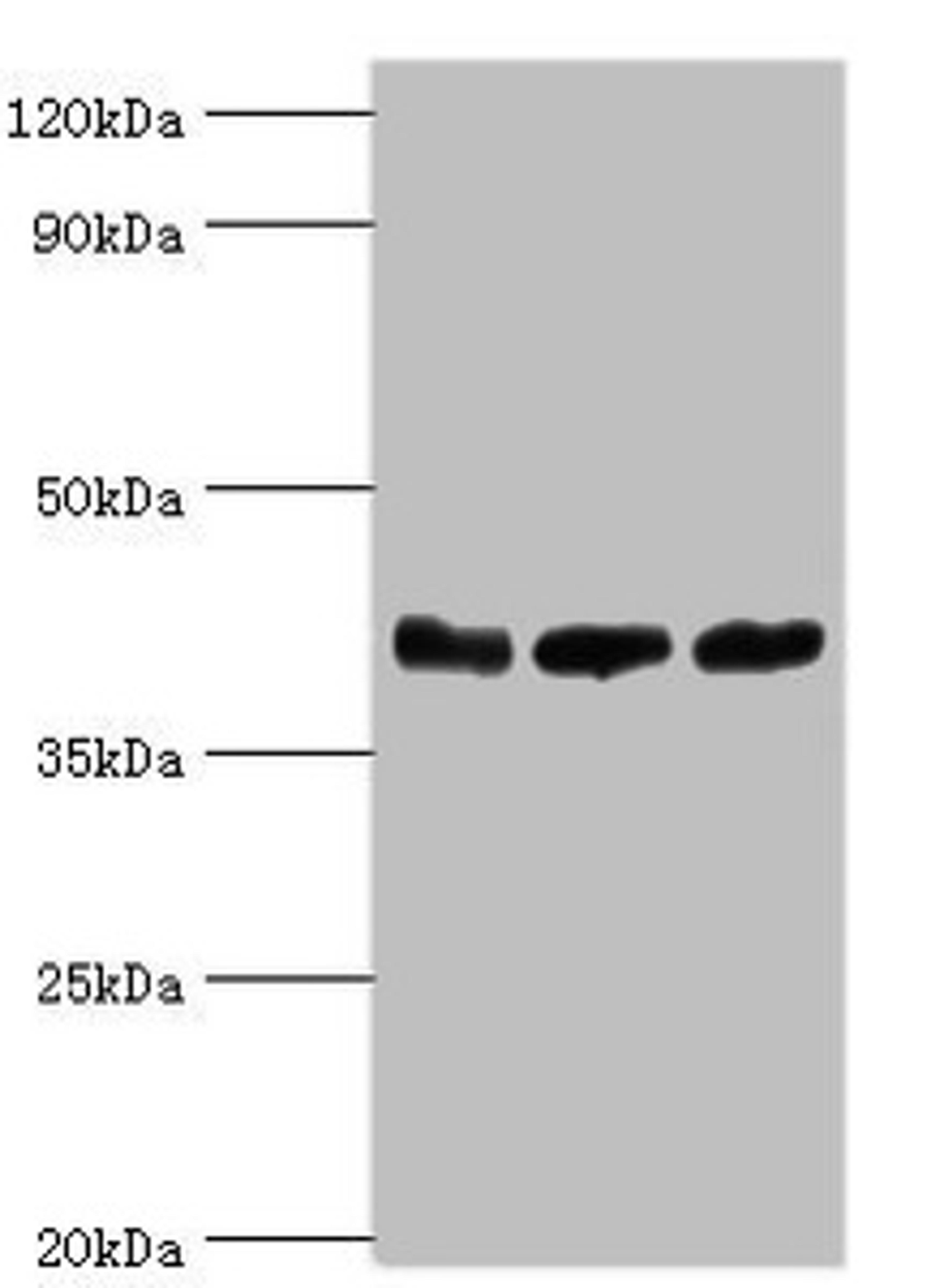 Western blot. All lanes: ADP-ribosylation factor GTPase-activating protein 1 antibody at 5ug/ml. Lane 1: PC-3 whole cell lysate. Lane 2: Hela whole cell lysate. Lane 3: Mouse brain tissue. Secondary. Goat polyclonal to rabbit IgG at 1/10000 dilution. Predicted band size: 45, 46, 32, 40 kDa. Observed band size: 45 kDa.