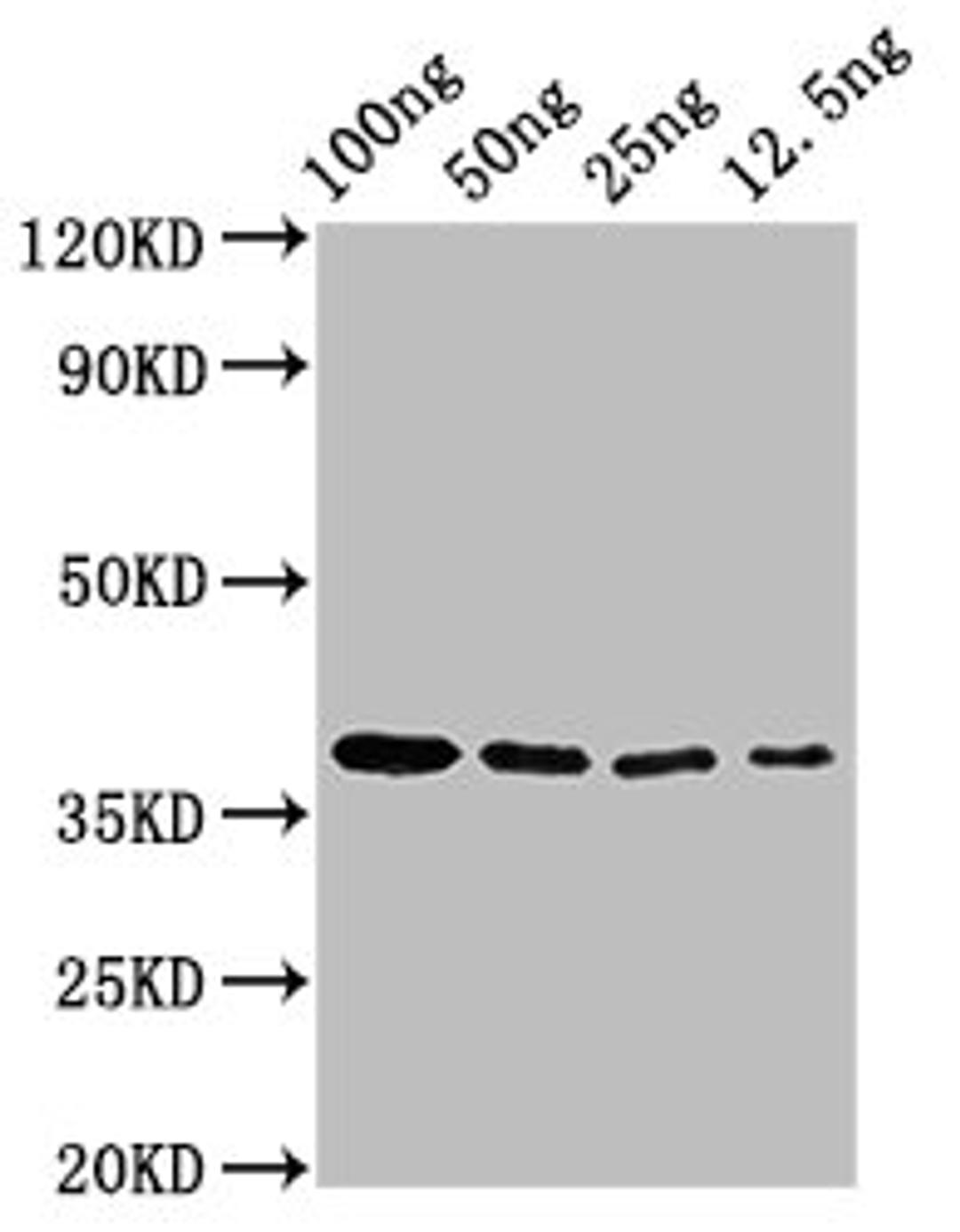 Western Blot. Positive WB detected in Recombinant protein. All lanes: BZLF2 antibody at 3µg/ml. Secondary. Goat polyclonal to rabbit IgG at 1/50000 dilution. Predicted band size: 38 kDa. Observed band size: 38 kDa