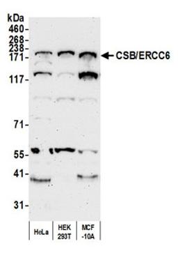 Detection of human CSB/ERCC6 by western blot.