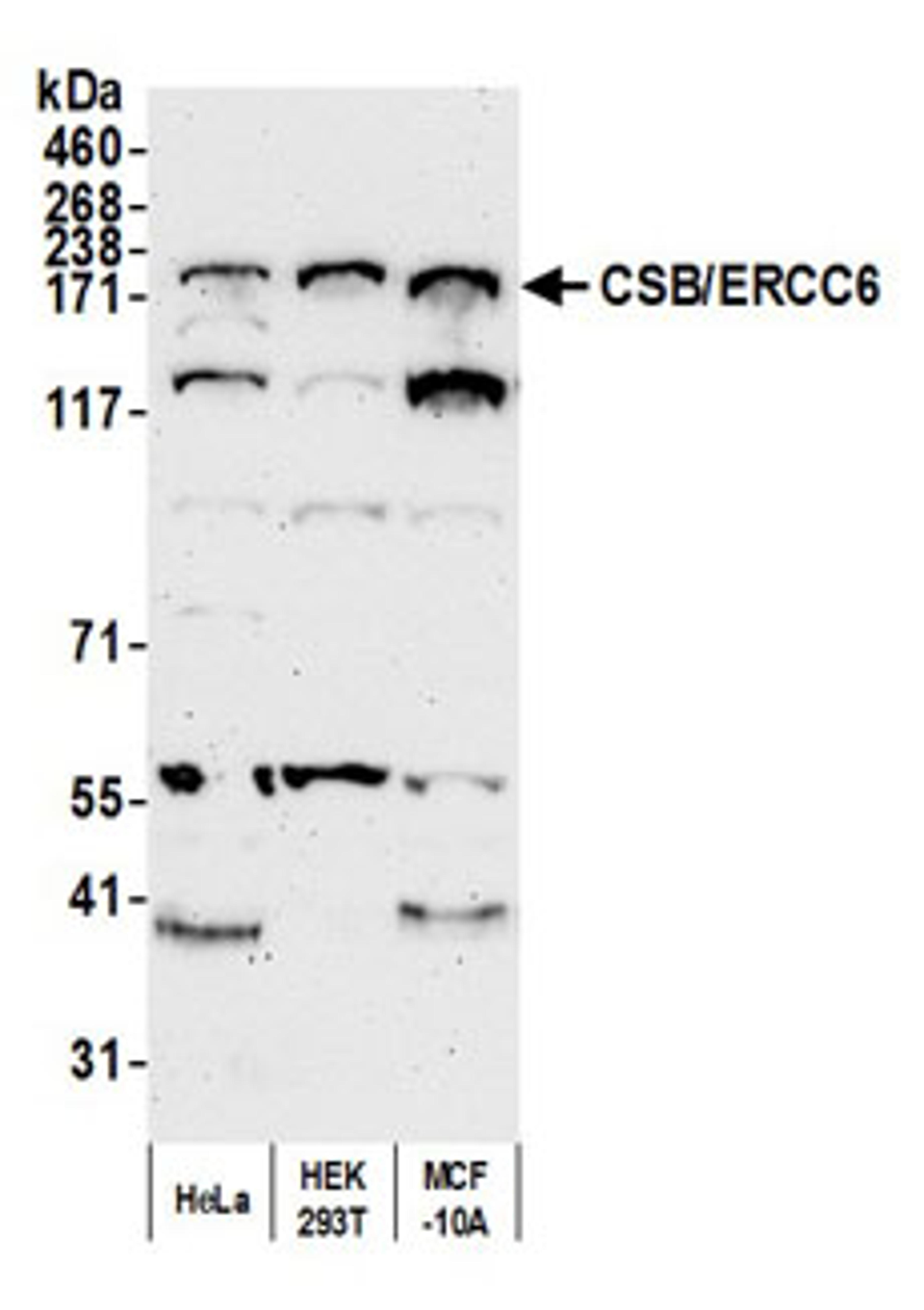 Detection of human CSB/ERCC6 by western blot.