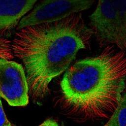 Immunocytochemistry/Immunofluorescence: SERBP1 Antibody [NBP1-85660] - Staining of human cell line U-2 OS shows positivity in cytoplasm.