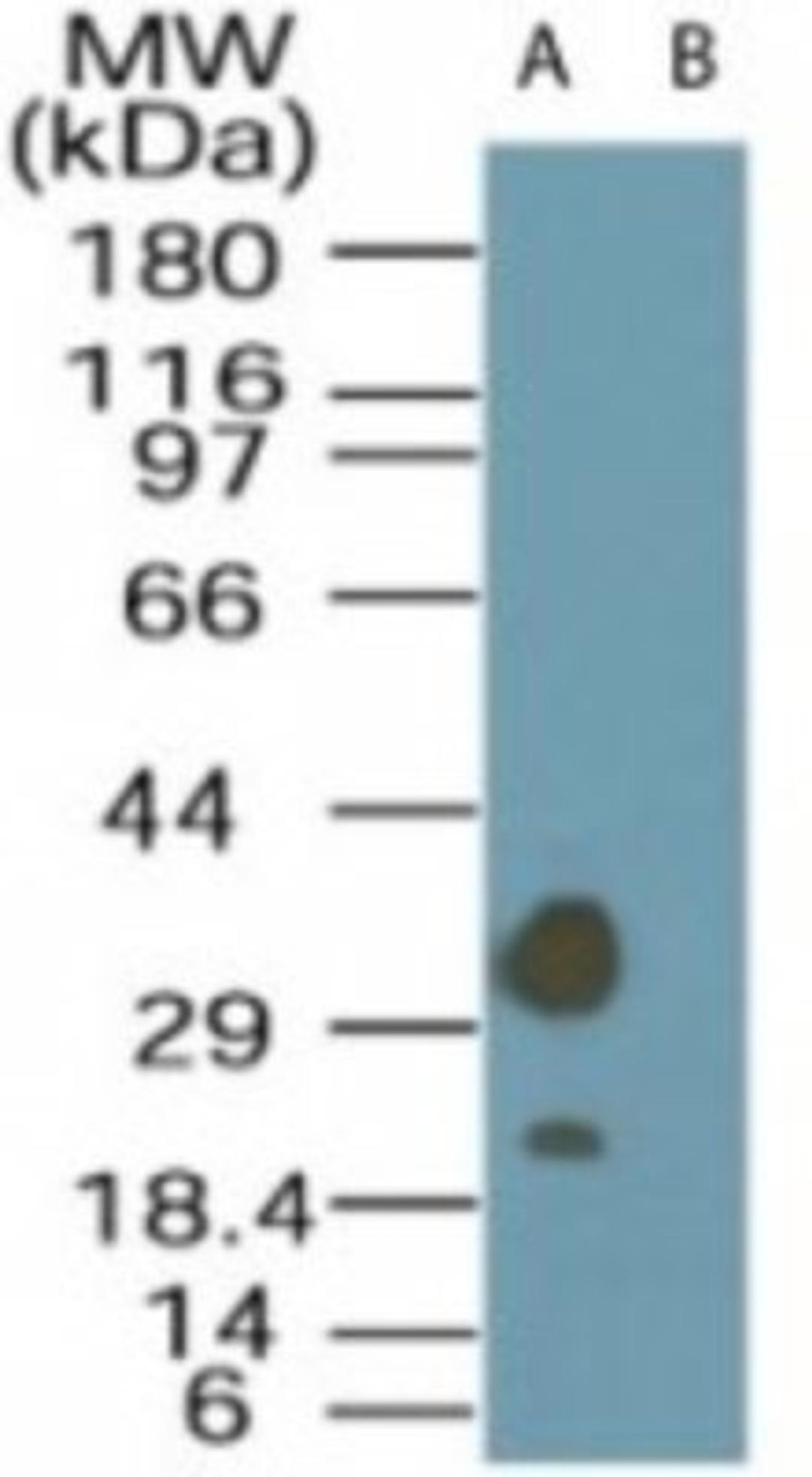 Western Blot: LYK5 Antibody [NBP2-24700] - Analysis of LYK5 in A549 cell lysate in the (A) absence and (B) presence of immunizing peptide using NBP2-24700 at 1 ug/ml.