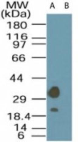 Western Blot: LYK5 Antibody [NBP2-24700] - Analysis of LYK5 in A549 cell lysate in the (A) absence and (B) presence of immunizing peptide using NBP2-24700 at 1 ug/ml.