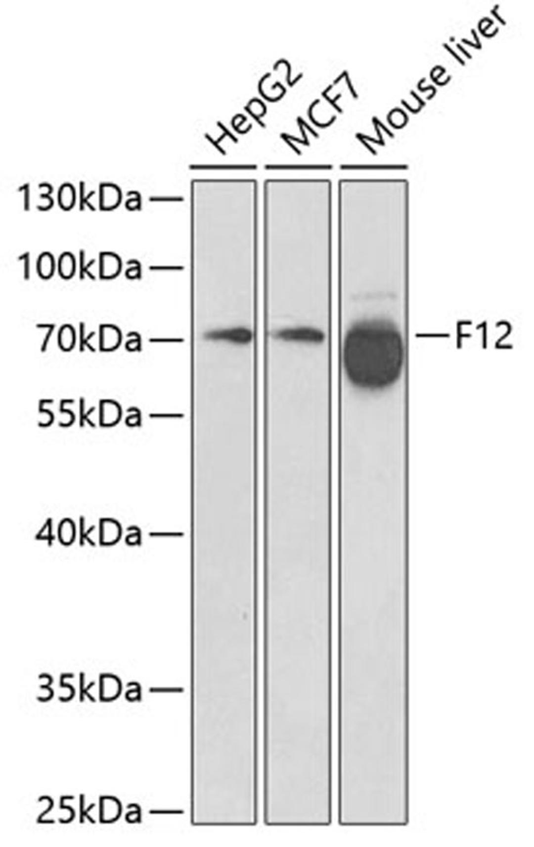 Western blot - F12 antibody (A1691)