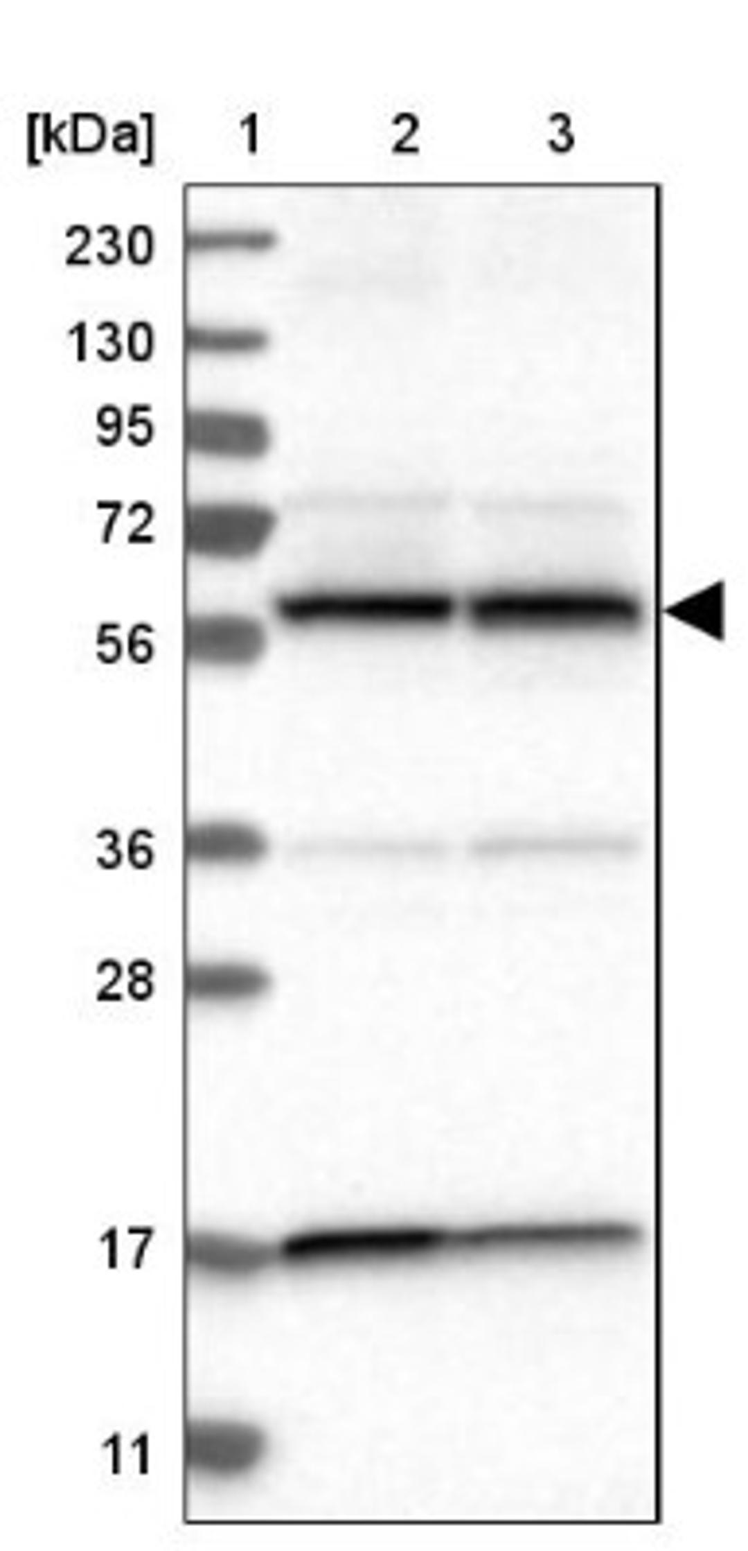 Western Blot: PPP3CC Antibody [NBP1-86656] - Lane 1: Marker [kDa] 230, 130, 95, 72, 56, 36, 28, 17, 11<br/>Lane 2: Human cell line RT-4<br/>Lane 3: Human cell line U-251MG sp