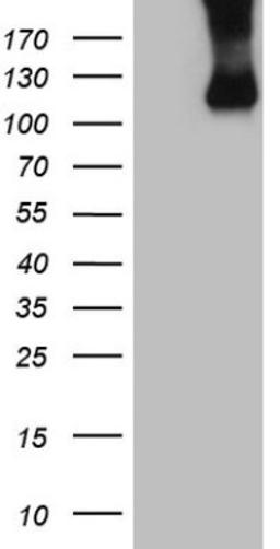 Western Blot: Common beta Chain Antibody (4H3) [NBP2-46365] - Analysis of HEK293T cells were transfected with the pCMV6-ENTRY control (Left lane) or pCMV6-ENTRY Common beta Chain.