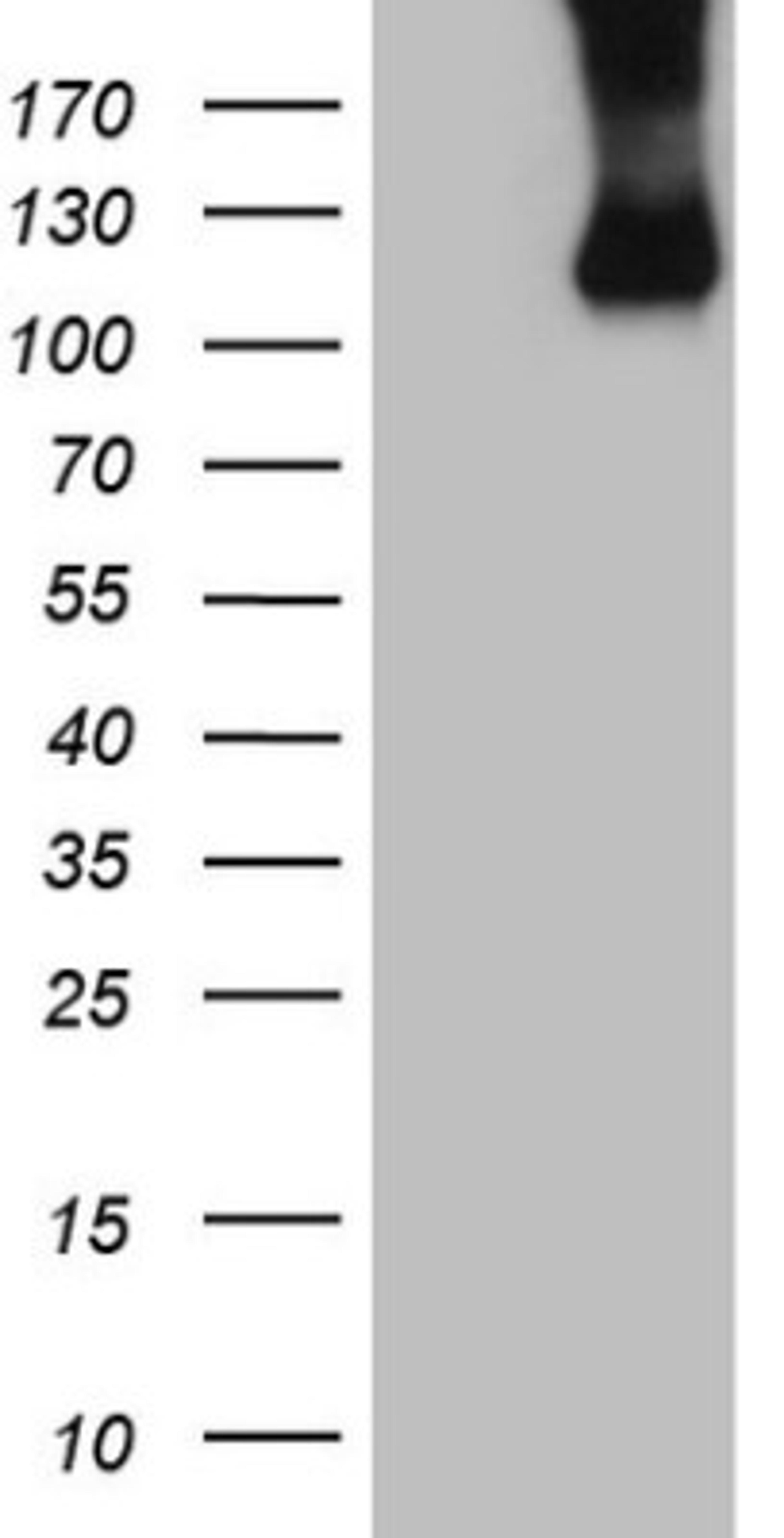 Western Blot: Common beta Chain Antibody (4H3) [NBP2-46365] - Analysis of HEK293T cells were transfected with the pCMV6-ENTRY control (Left lane) or pCMV6-ENTRY Common beta Chain.