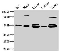 Western Blot. Positive WB detected in: 293 whole cell lysate, HL60 whole cell lysate, Rat liver tissue, Mouse kidney tissue, Mouse liver tissue. All lanes: NADK2 antibody at 4µg/ml. Secondary. Goat polyclonal to rabbit IgG at 1/50000 dilution. Predicted band size: 50, 46, 32 kDa. Observed band size: 50, 46 kDa