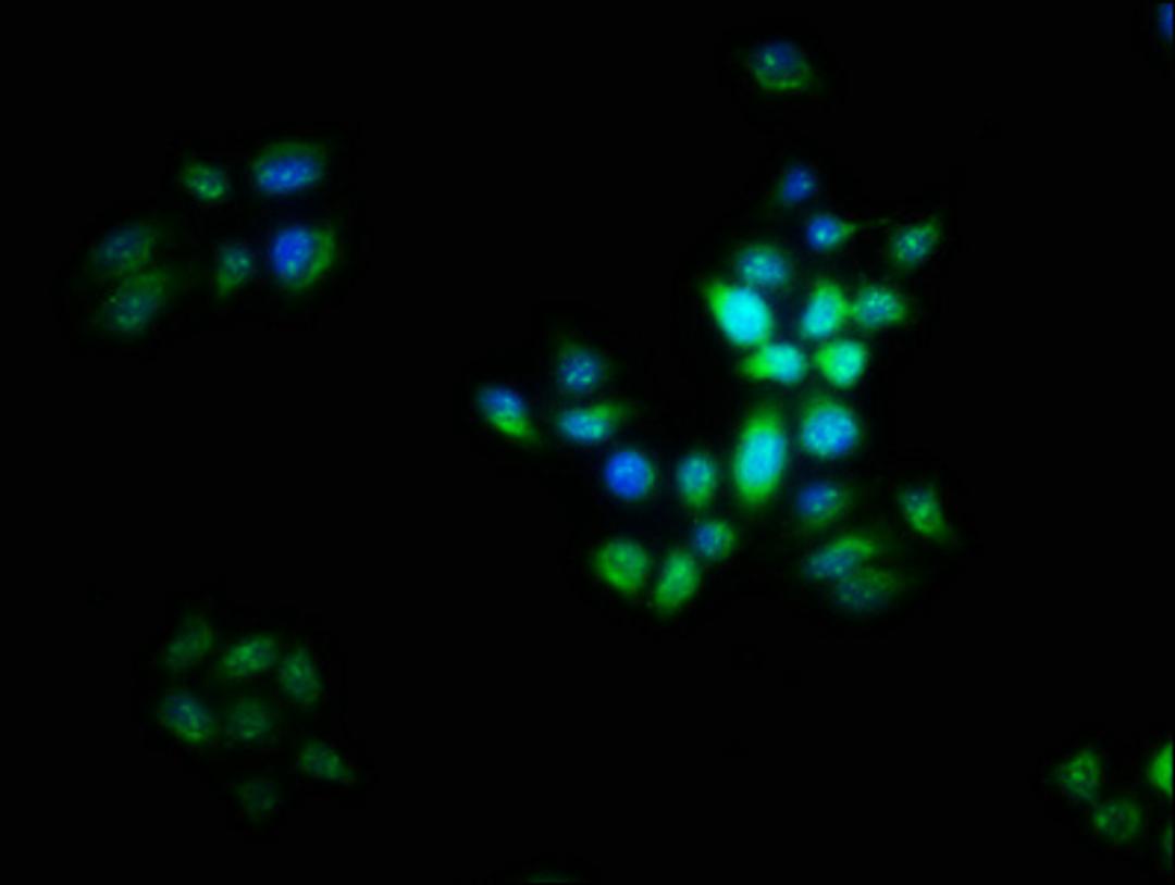 Immunofluorescence staining of PC-3 cells with CSB-PA822702LA01HU at 1:16, counter-stained with DAPI. The cells were fixed in 4% formaldehyde, permeabilized using 0.2% Triton X-100 and blocked in 10% normal Goat Serum. The cells were then incubated with the antibody overnight at 4&deg;C. The secondary antibody was Alexa Fluor 488-congugated AffiniPure Goat Anti-Rabbit IgG(H+L).