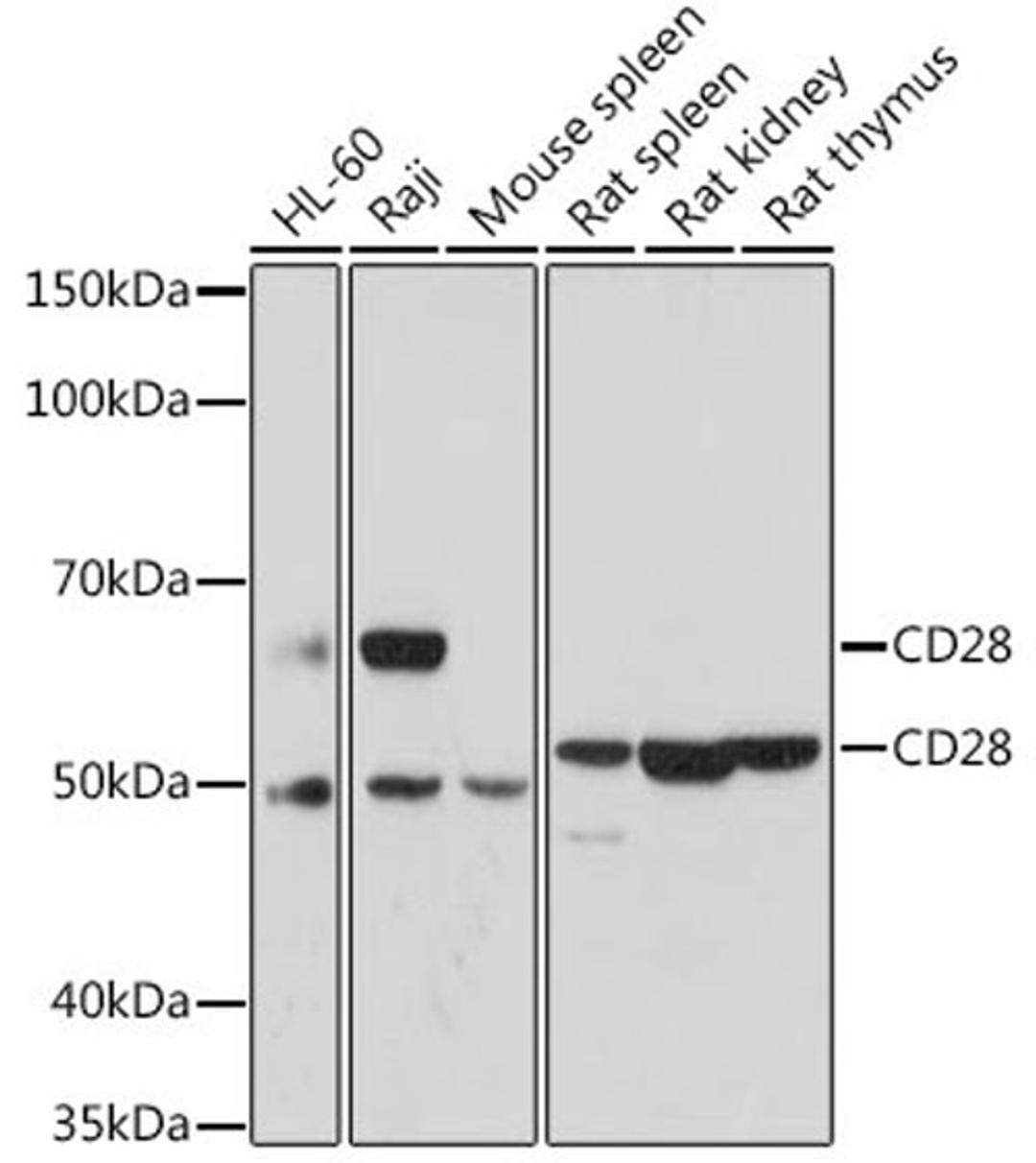 Western blot - CD28 antibody (A17447)