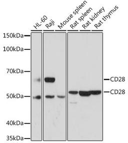 Western blot - CD28 antibody (A17447)