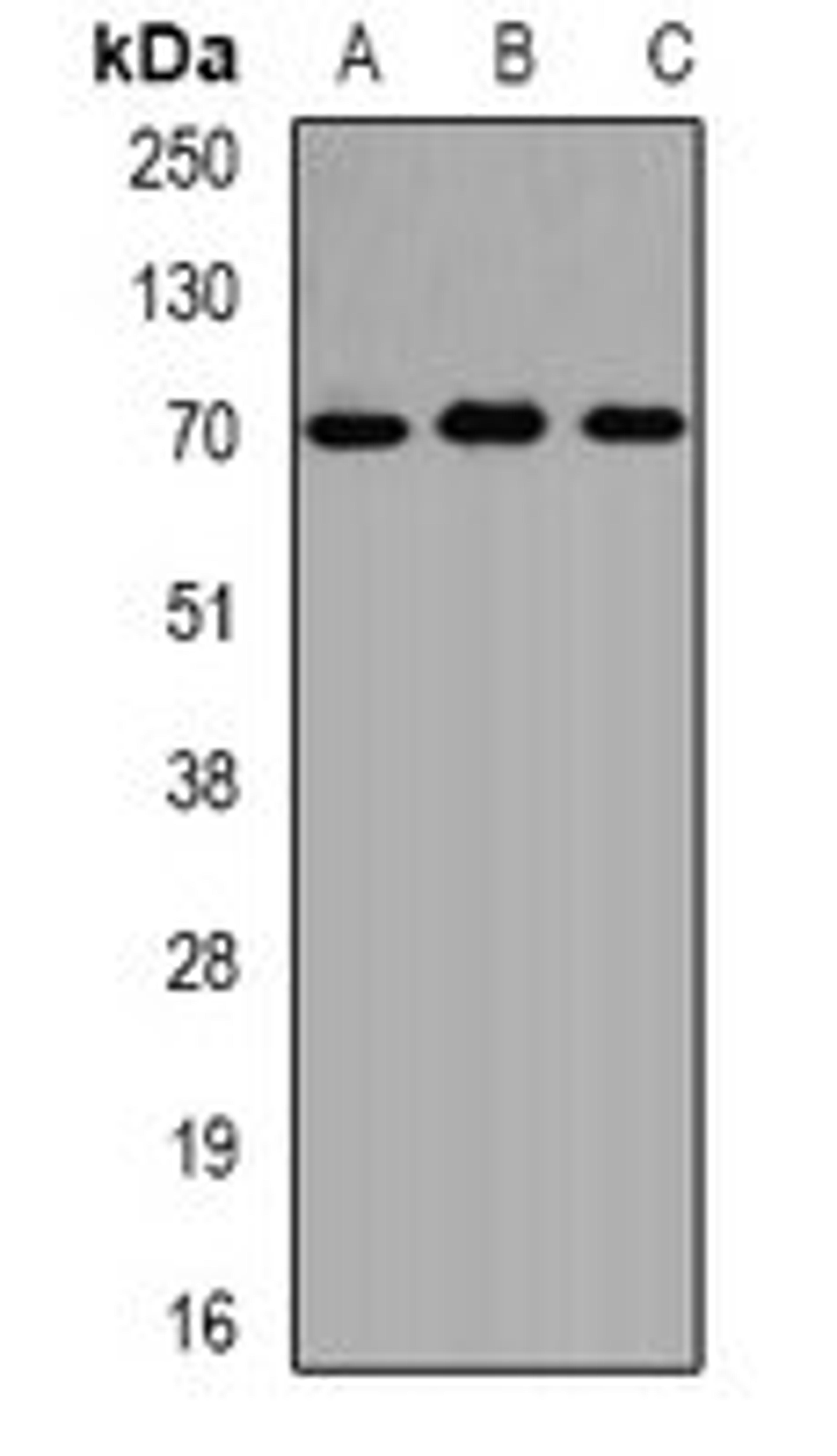 Western blot analysis of SW620 (Lane1), HepG2 (Lane2), mouse liver (Lane3) whole cell lysates using ALAS1 antibody