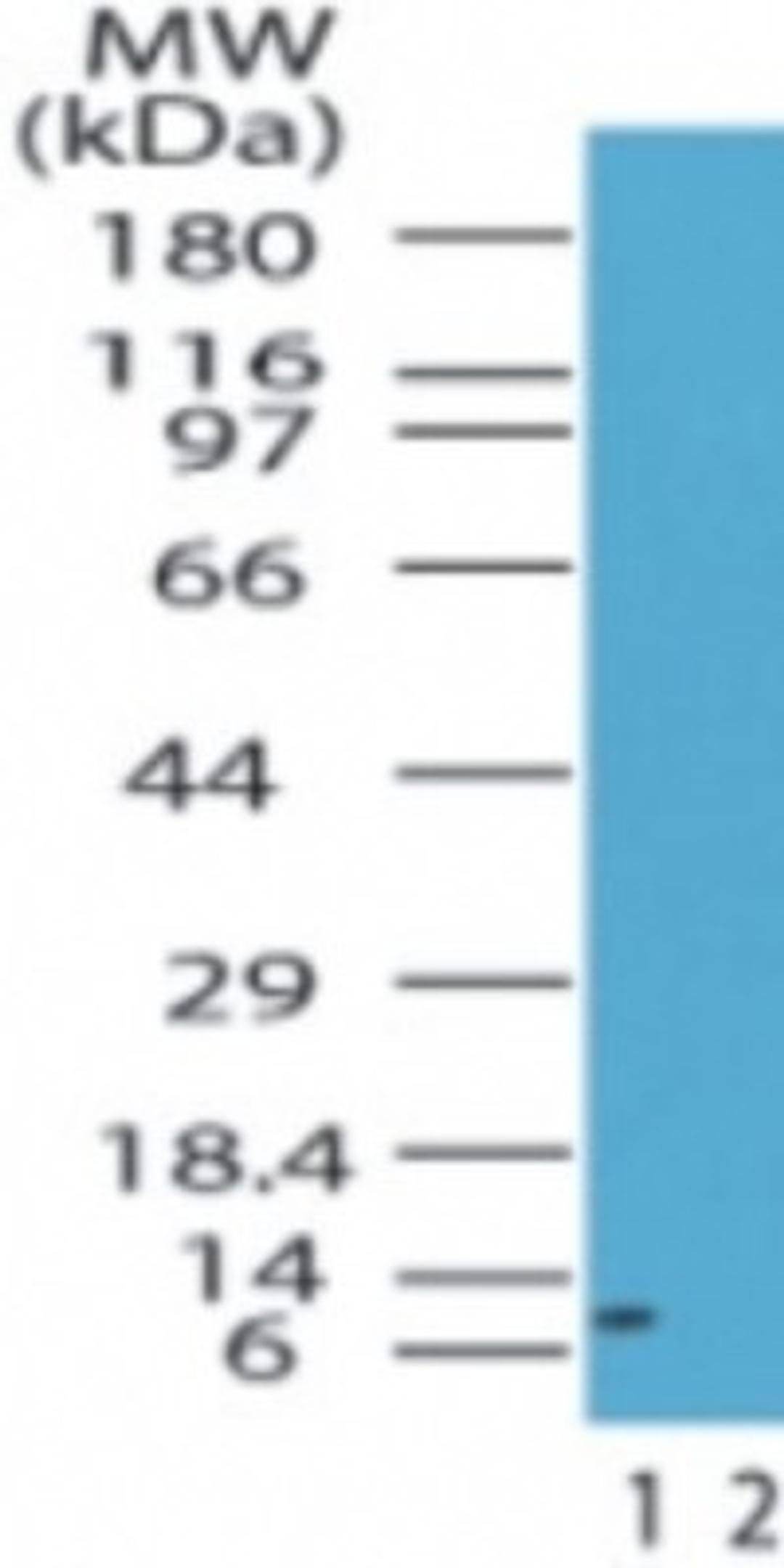 Western Blot: HMGA1 Antibody [NB100-56468] - Analysis of HMGA1 in the 1) absence and 2) presence of immunizing peptide in human pancreas lysate using this antibody at 1 ug/ml.