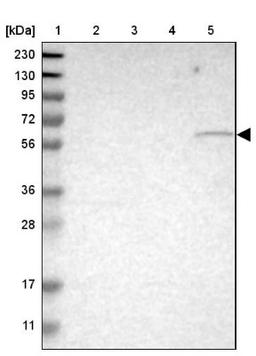 Western Blot: ST6GAL2 Antibody [NBP1-81364] - Lane 1: Marker [kDa] 230, 130, 95, 72, 56, 36, 28, 17, 11<br/>Lane 2: Human cell line RT-4<br/>Lane 3: Human cell line U-251MG sp<br/>Lane 4: Human plasma (IgG/HSA depleted)<br/>Lane 5: Human liver tissue