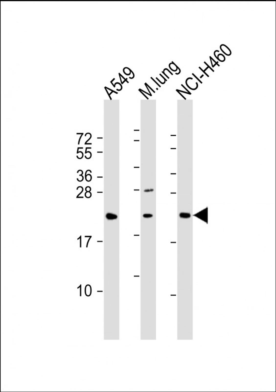 Western Blot at 1:2000 dilution Lane 1: A549 whole cell lysate Lane 2: mouse lung lysate Lane 3: NCI-H460 whole cell lysate Lysates/proteins at 20 ug per lane.