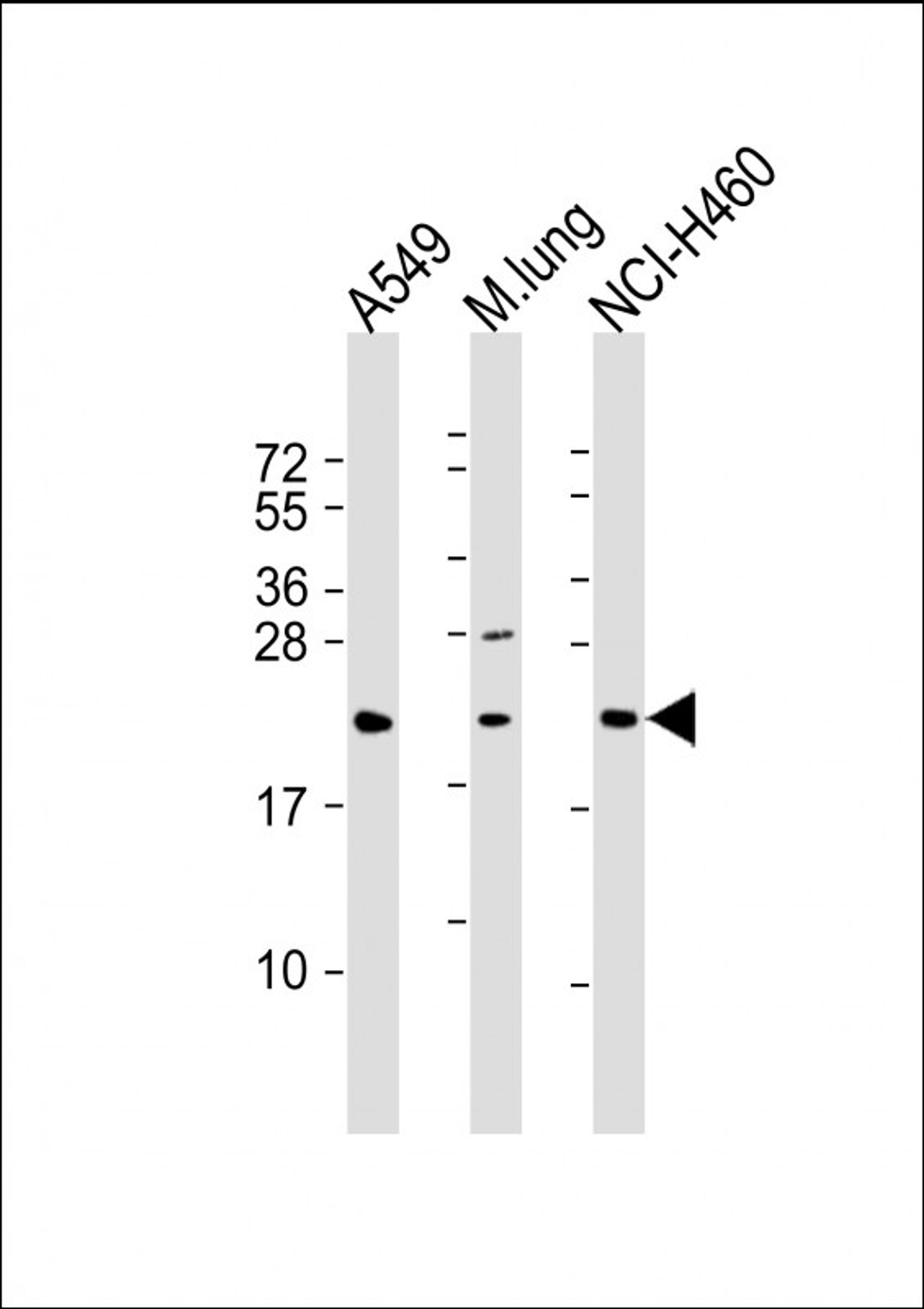 Western Blot at 1:2000 dilution Lane 1: A549 whole cell lysate Lane 2: mouse lung lysate Lane 3: NCI-H460 whole cell lysate Lysates/proteins at 20 ug per lane.