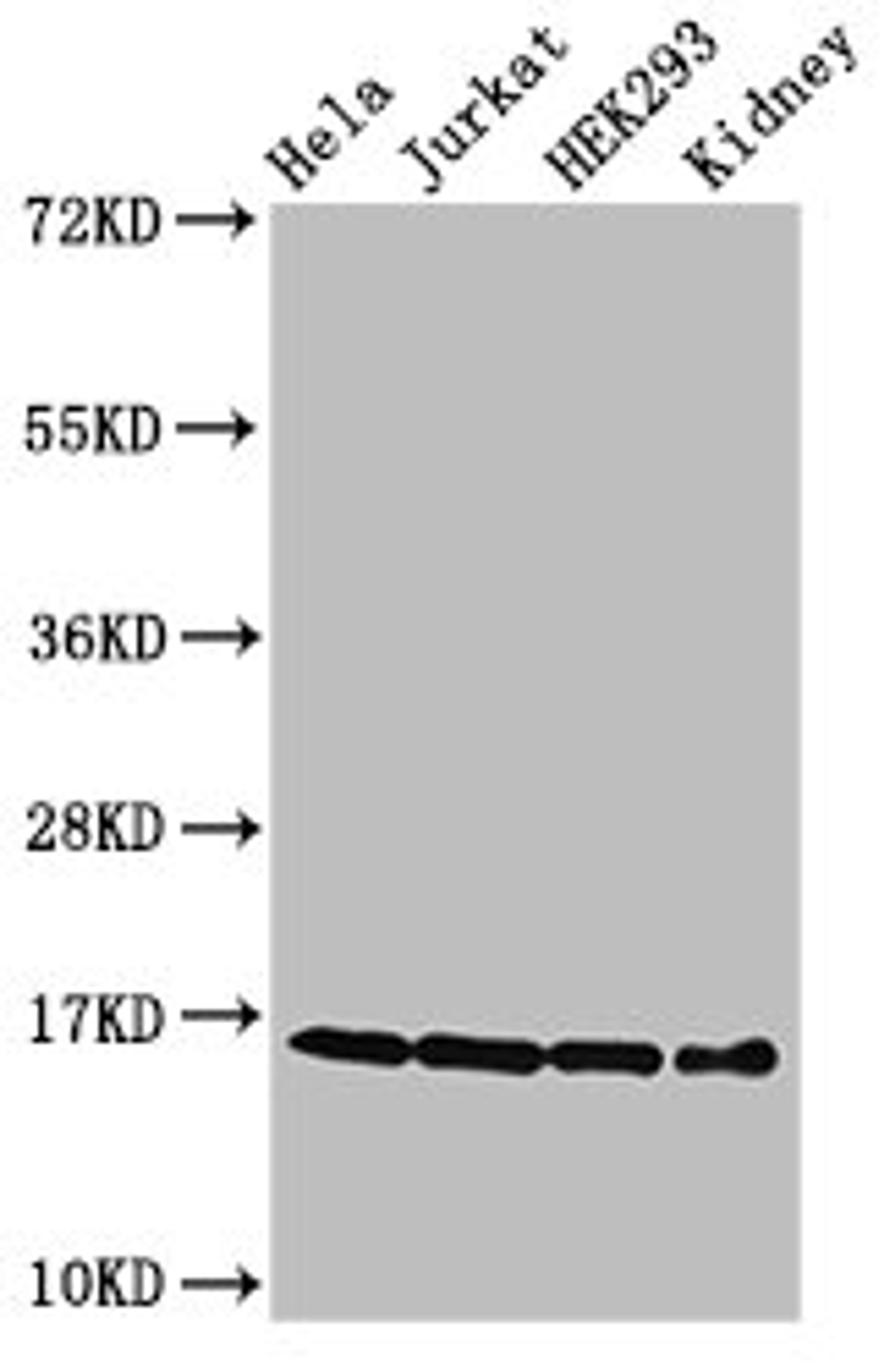 Western Blot. Positive WB detected in: Hela cell acid extracts, Jurkat cell acid extracts, HEK293 cell acid extracts, Mouse kidney tissue. All lanes: HIST1H3A antibody at 0.3µg/ml. Secondary. Goat polyclonal to rabbit IgG at 1/50000 dilution. Predicted band size: 16 kDa. Observed band size: 16 kDa