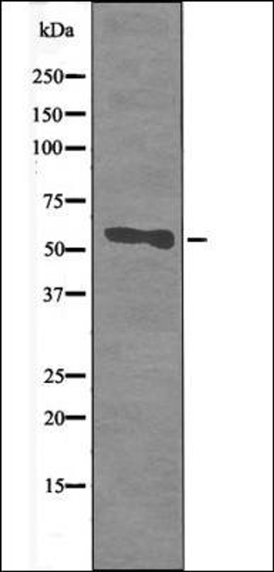 Western blot analysis of LPS treated HeLa whole cell lysates using CD66/CEACAM1 -Phospho-Ser508- antibody