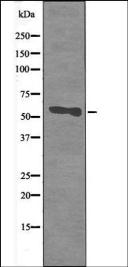 Western blot analysis of LPS treated HeLa whole cell lysates using CD66/CEACAM1 -Phospho-Ser508- antibody