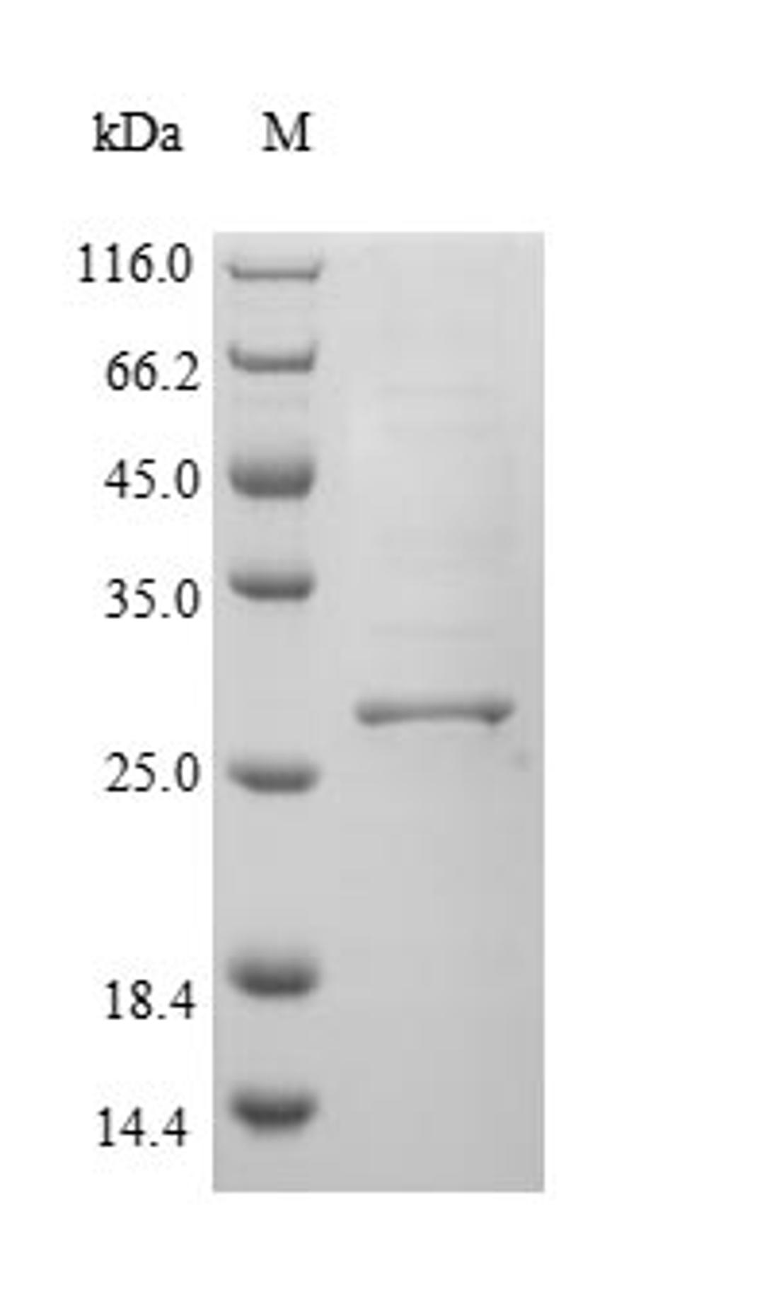 (Tris-Glycine gel) Discontinuous SDS-PAGE (reduced) with 5% enrichment gel and 15% separation gel.