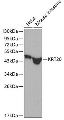 Western blot - KRT20 antibody (A0248)