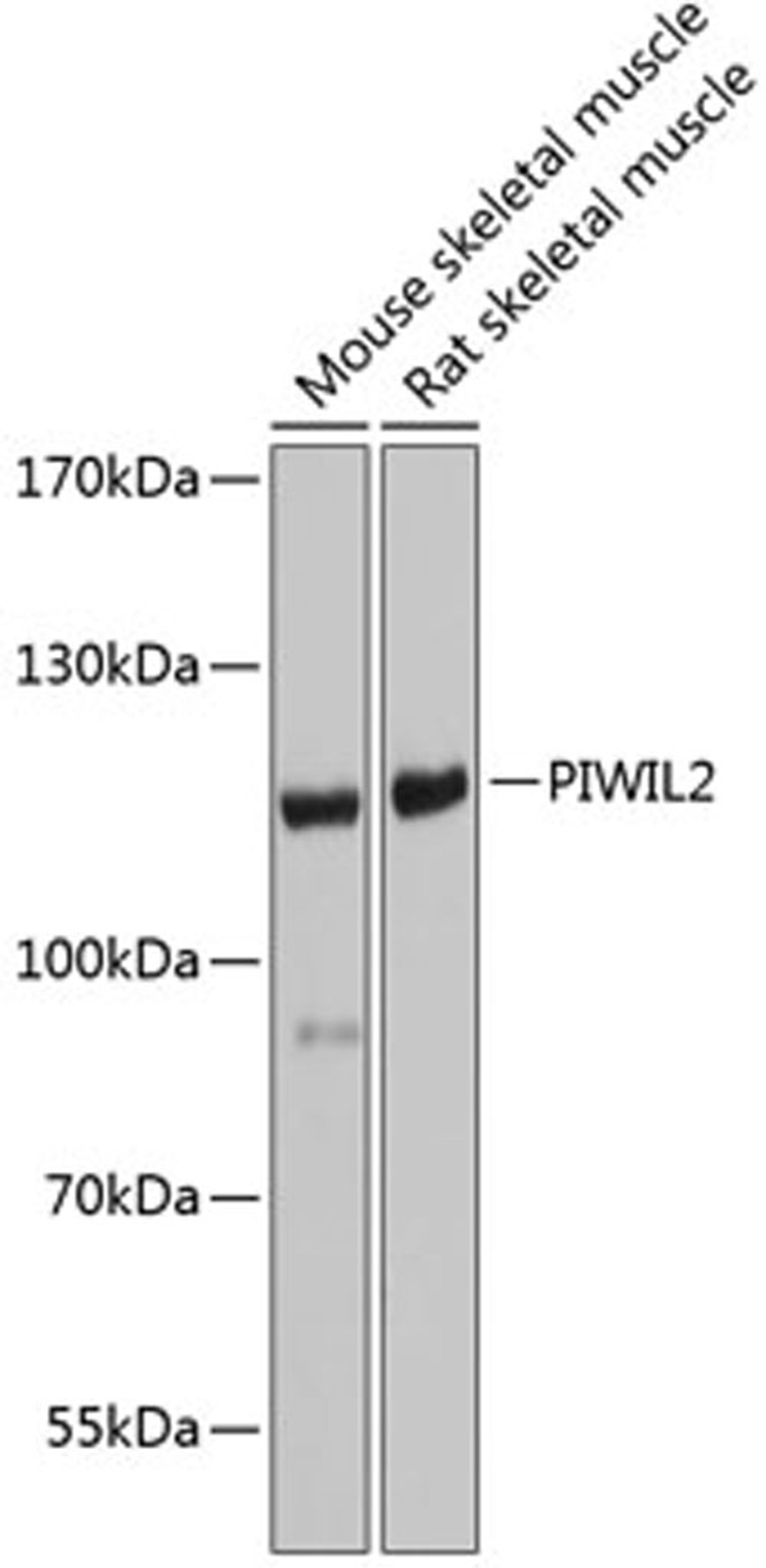 Western blot - PIWIL2 antibody (A6044)