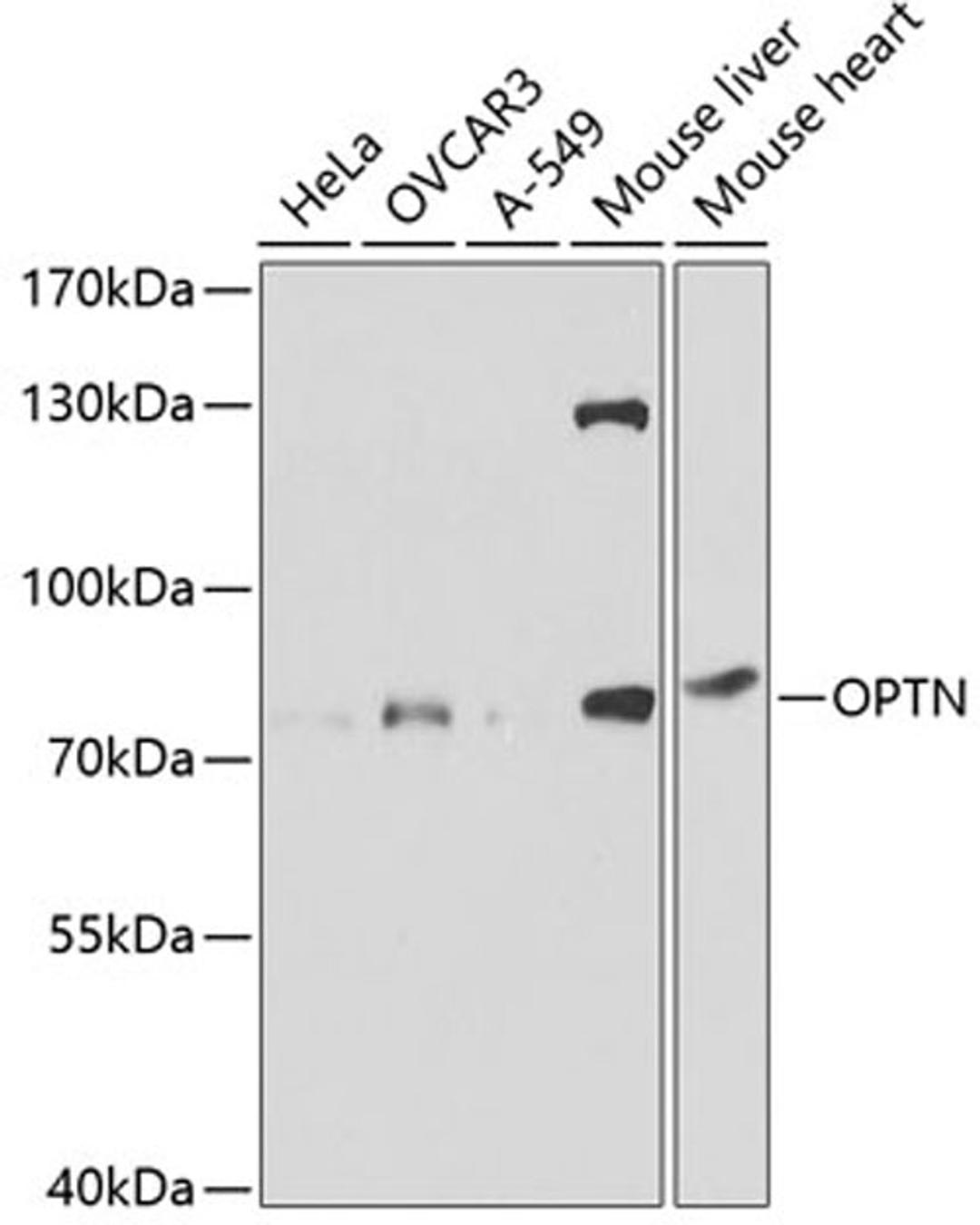 Western blot - OPTN antibody (A1845)